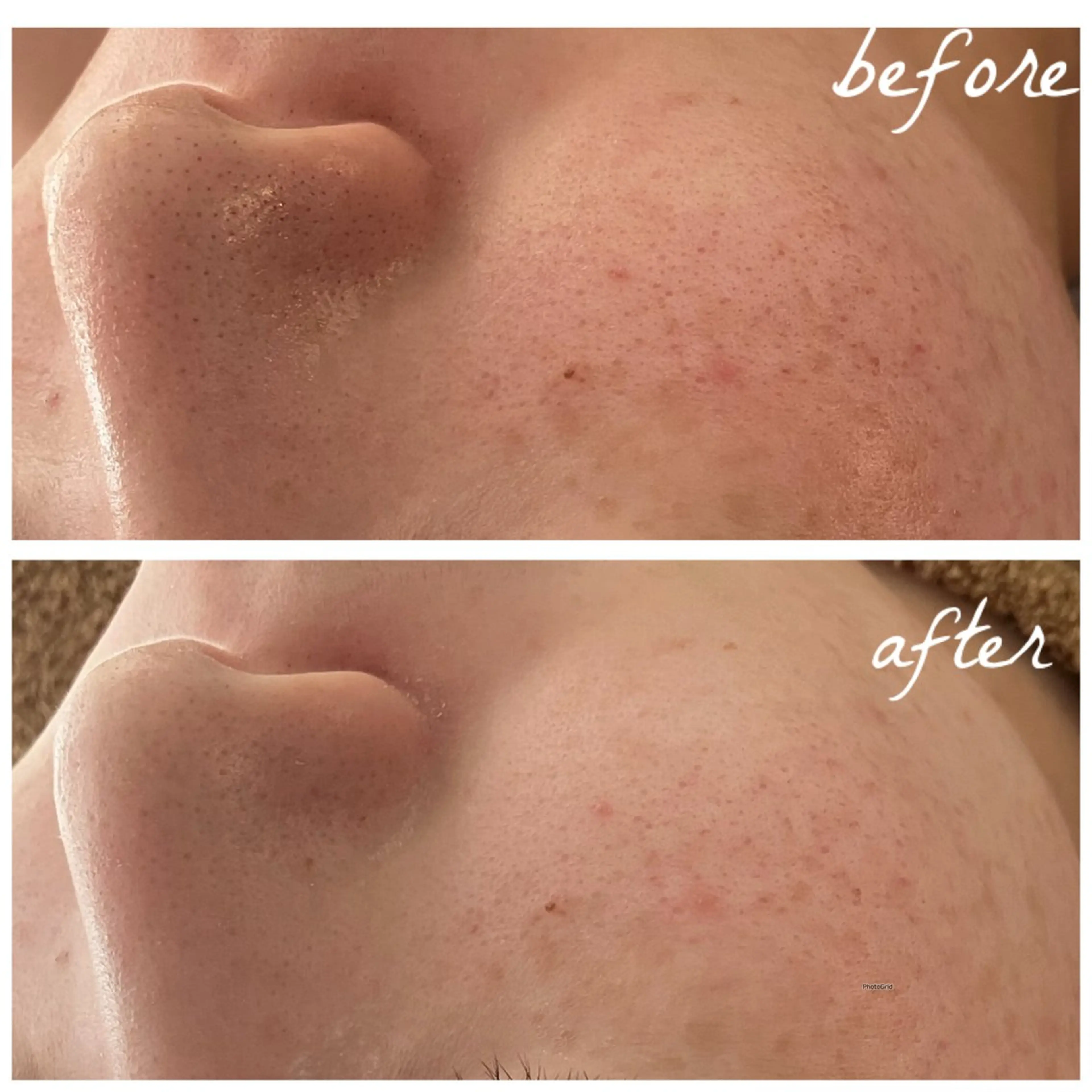 メンズ エステ メナード岐阜茜部 杉浦のエステ・リラクイメージ