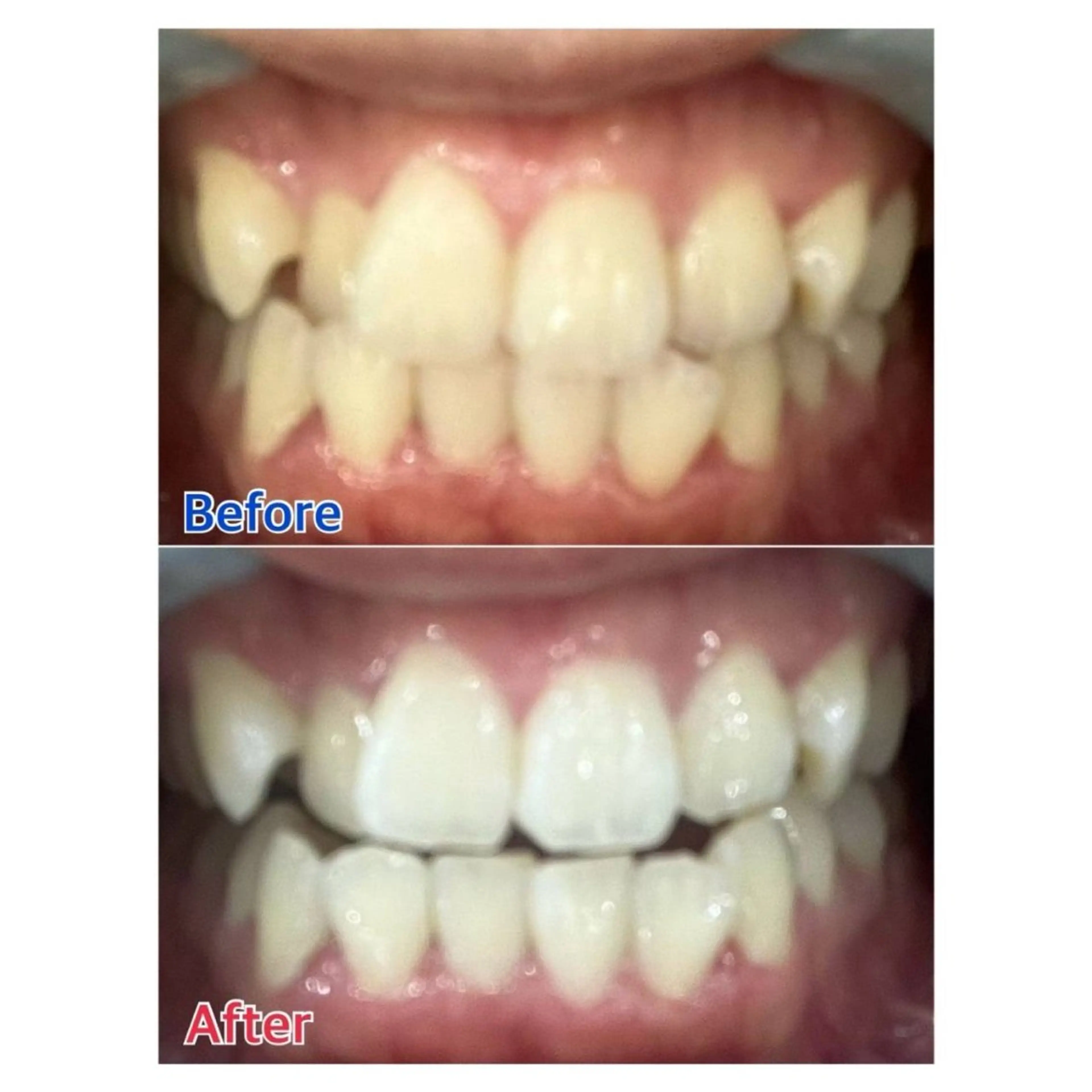 MBEAUTYSALON 千葉店・京成大久保所属・Melty 輝のその他イメージ