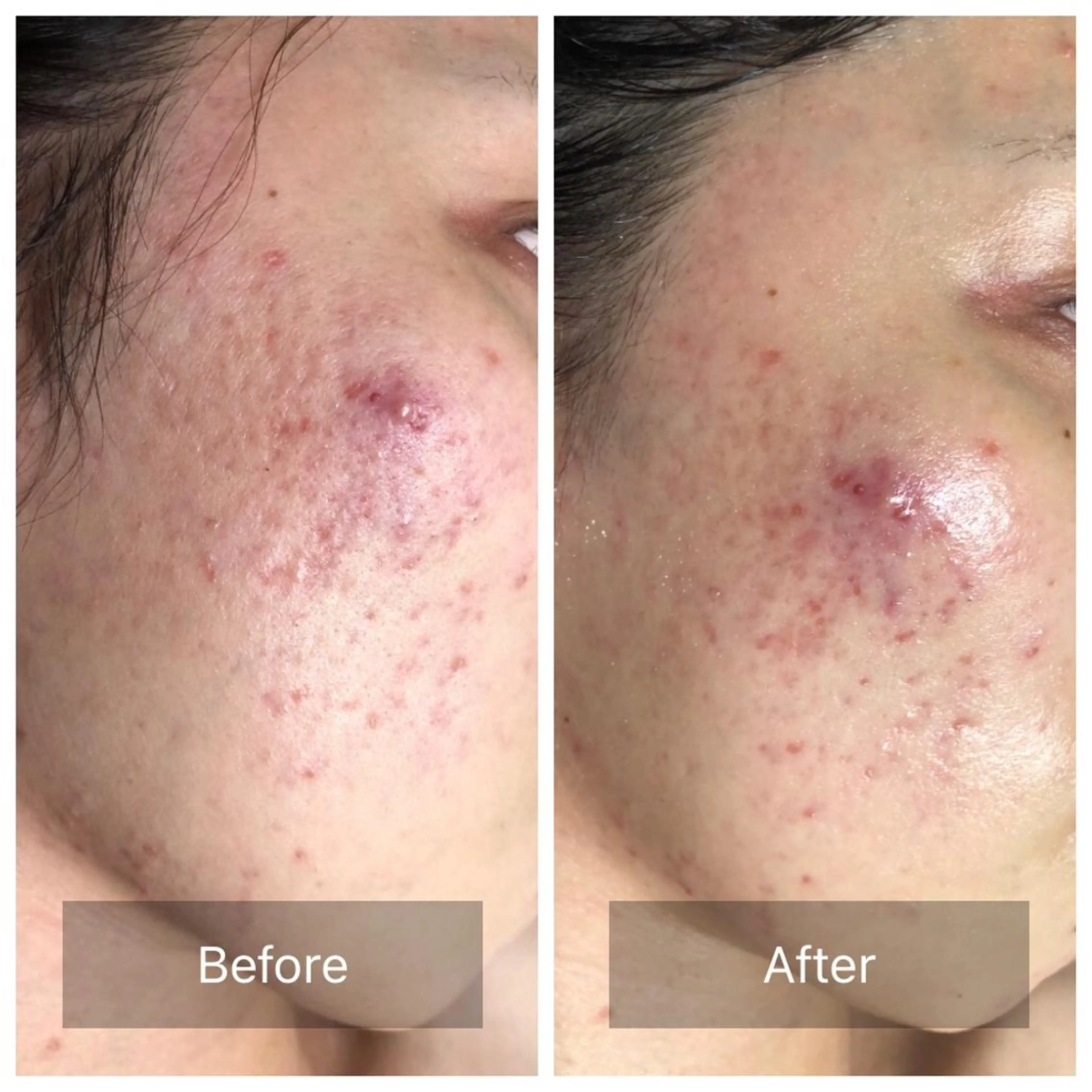 Radiance H.Oのエステ・リラクイメージ