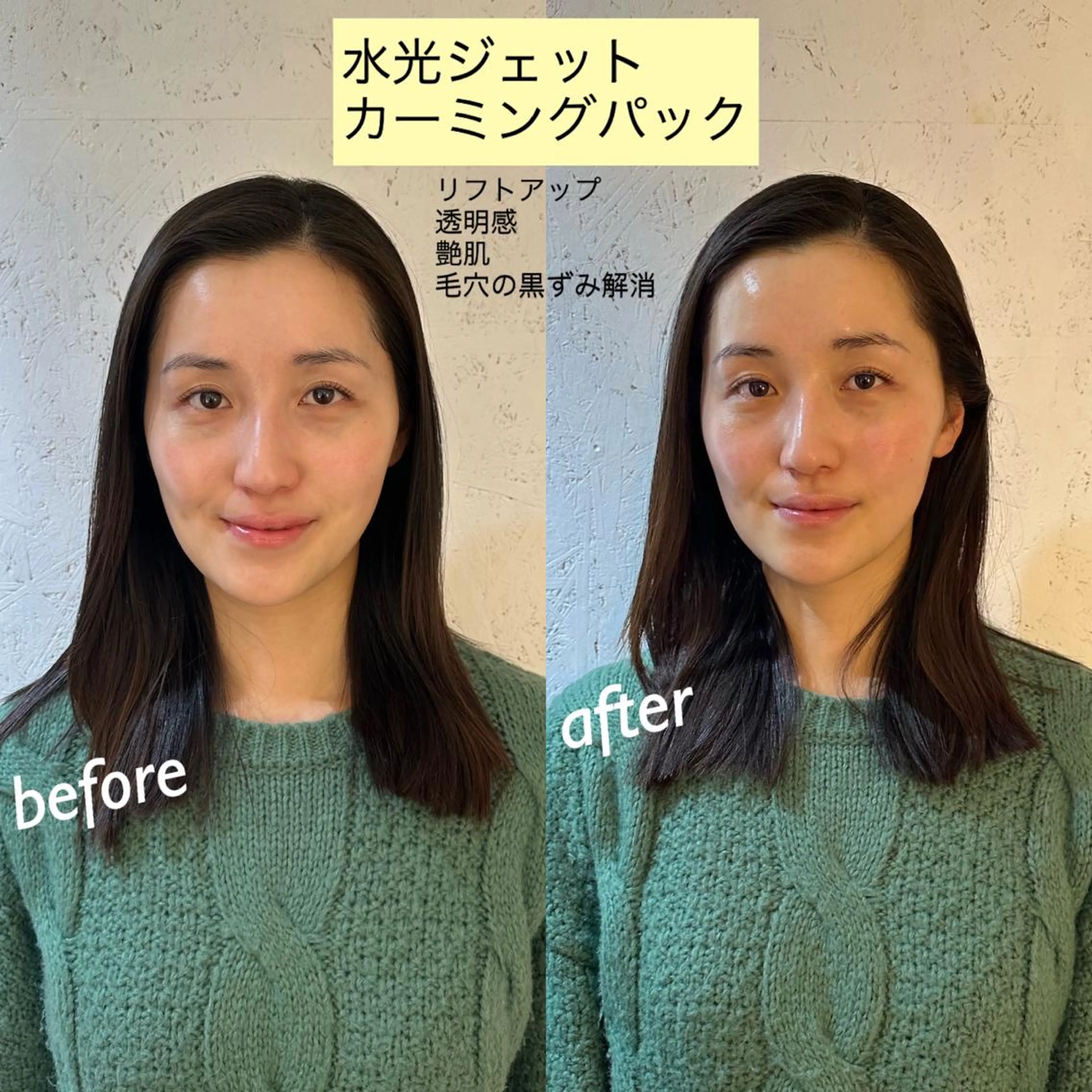 うなじ脱毛/美肌脱毛 LABELのエステ・リラクイメージ