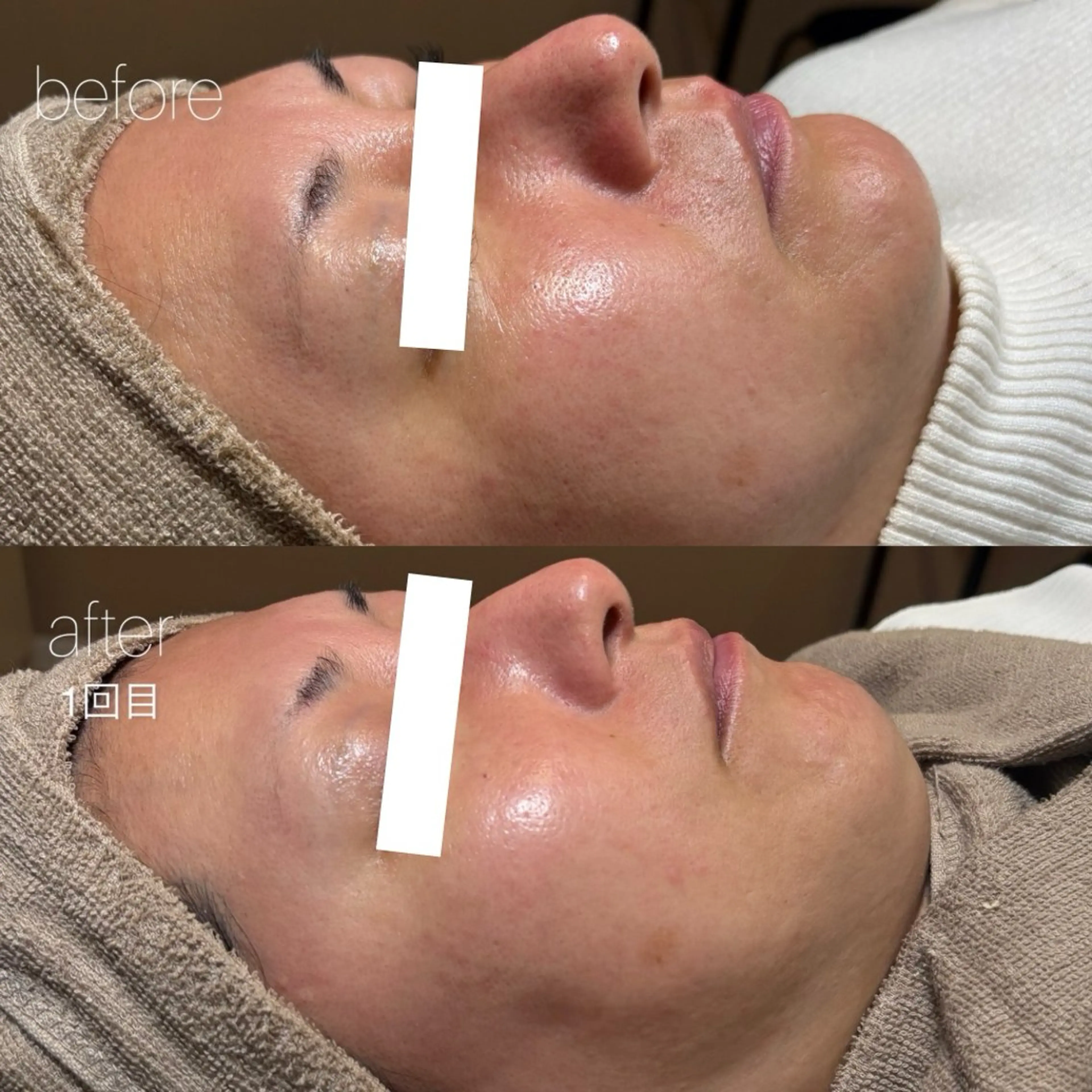 エステ Lassy Yuriの眉毛・アイブロウイメージ