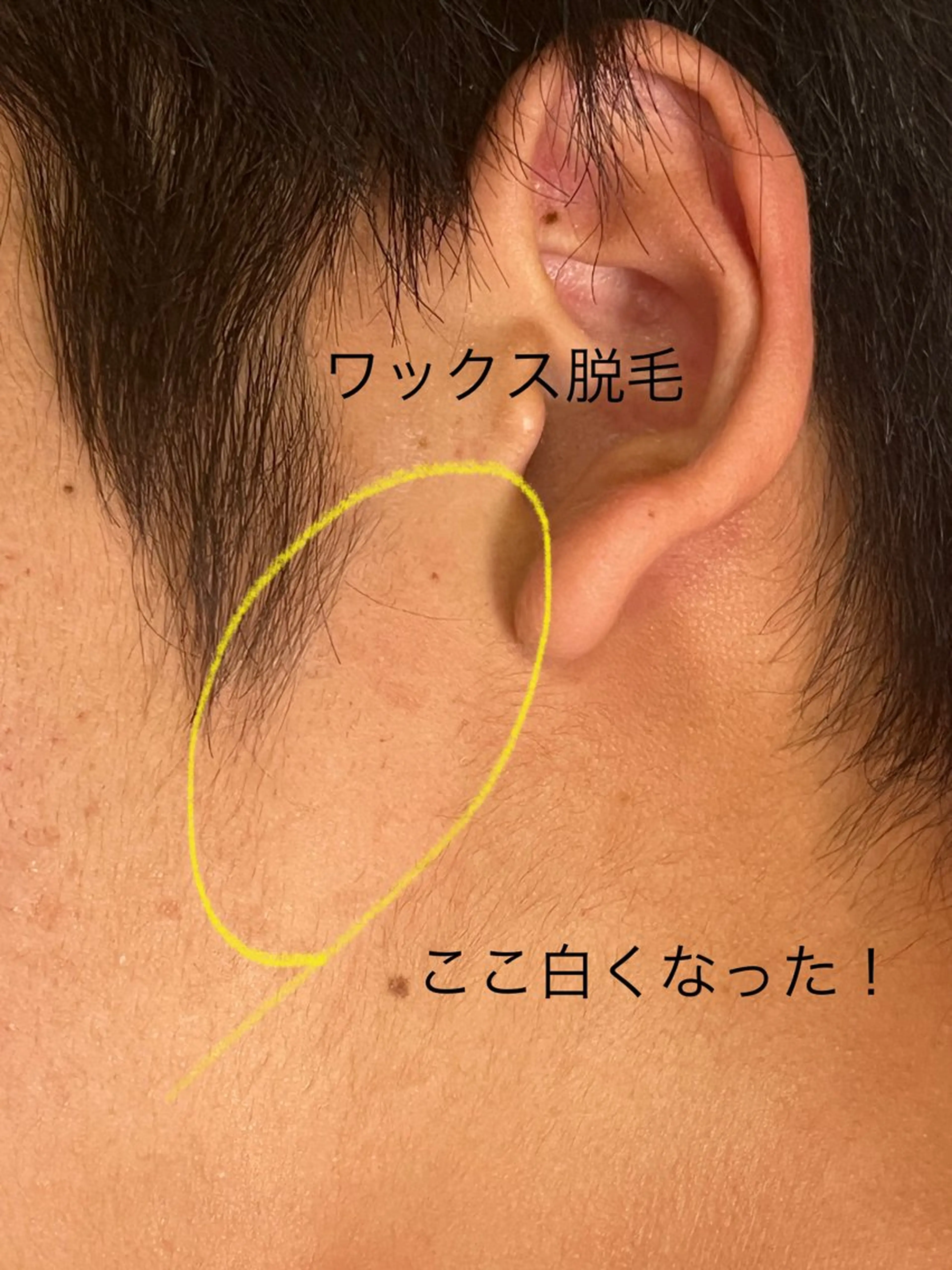 脱毛 De I'm 名古屋栄店所属・原 いず美のエステ・リラクイメージ