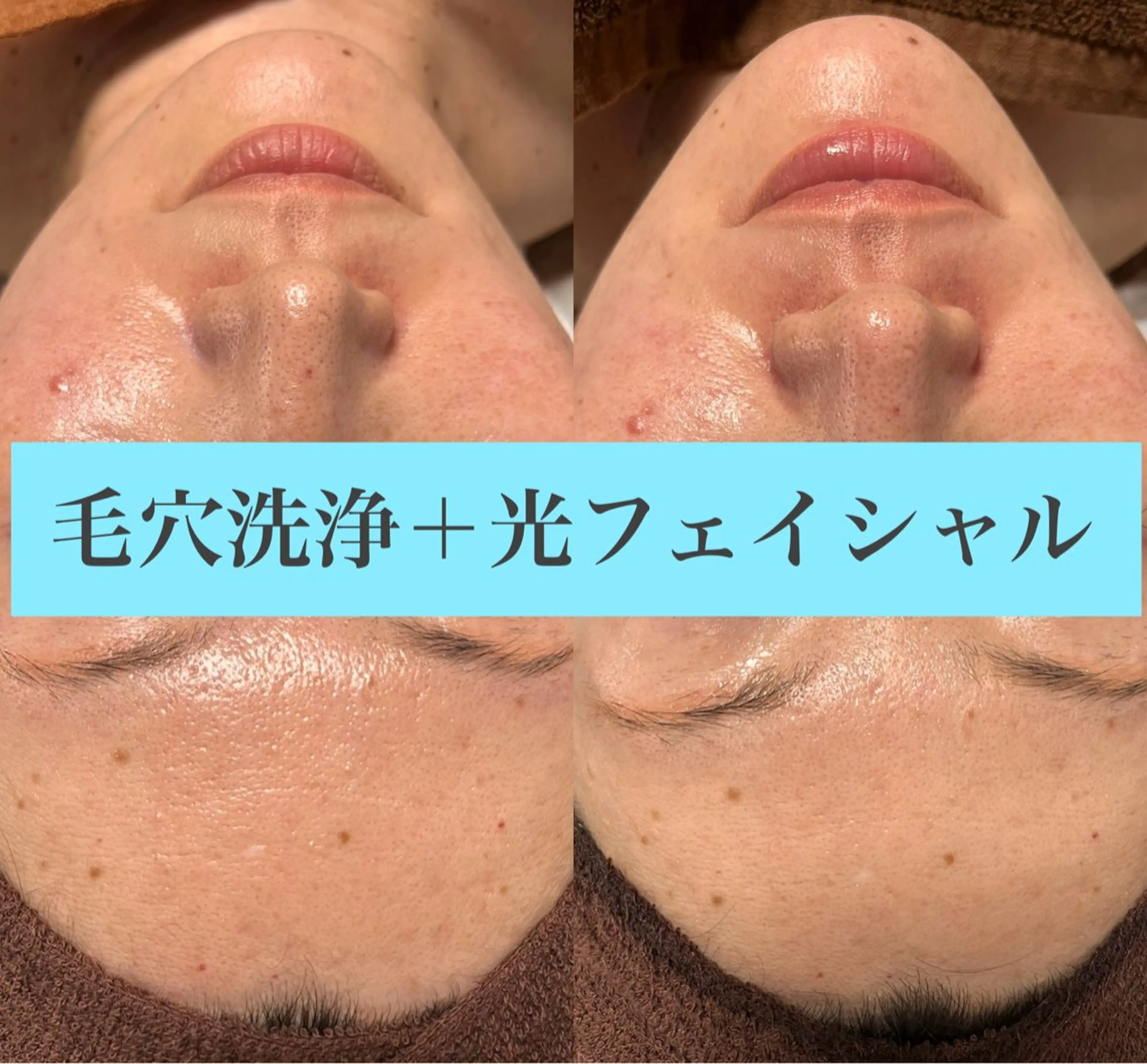 エステ Lea Makana-レアマカナ所属・毛穴洗浄🍀脱毛🍀 光フェイシャル🍀のエステ・リラクイメージ