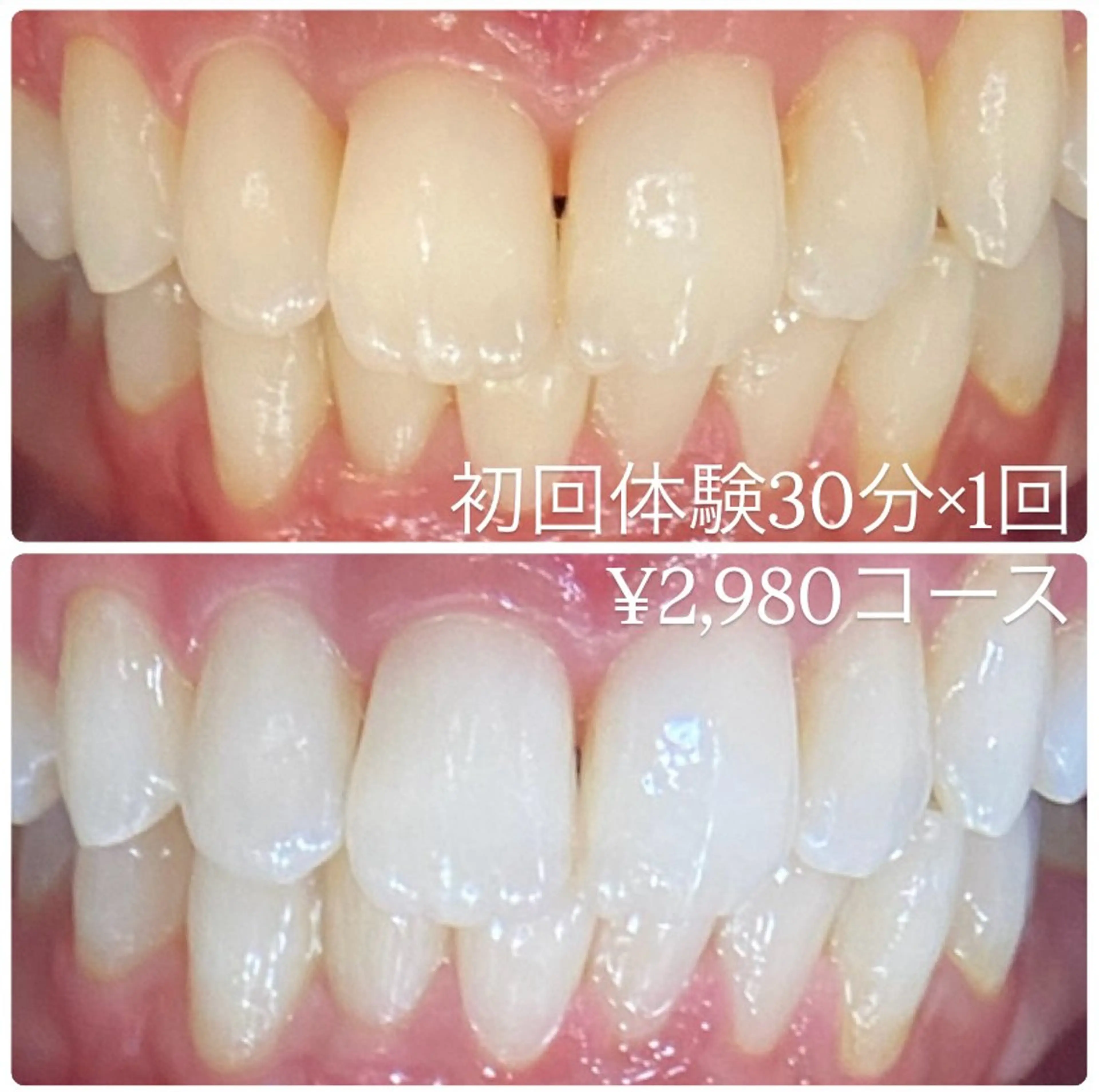 PLATINUM Beauty 横浜店所属・ホワイトニングルーム 横浜店のその他イメージ