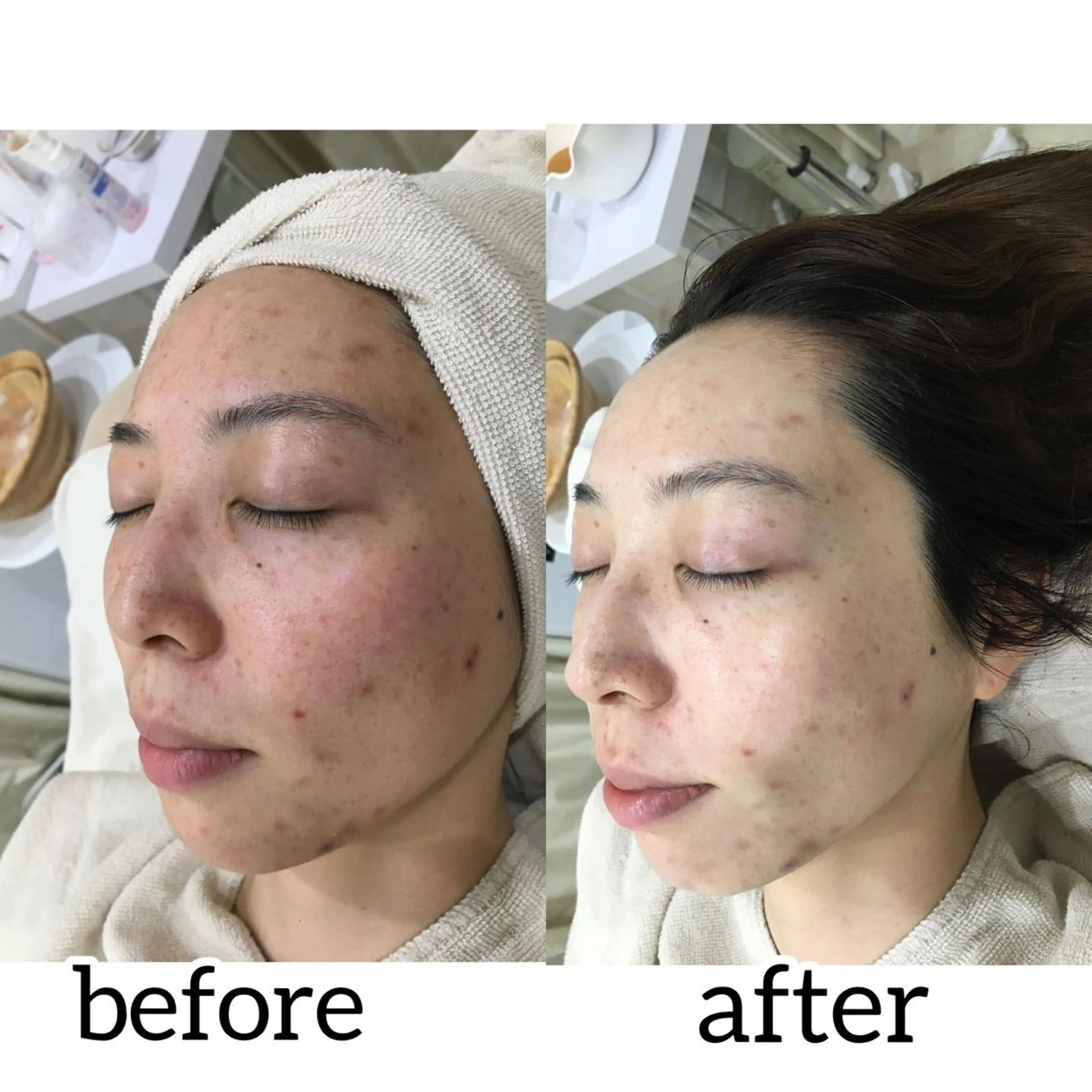 laluna saki...のその他イメージ