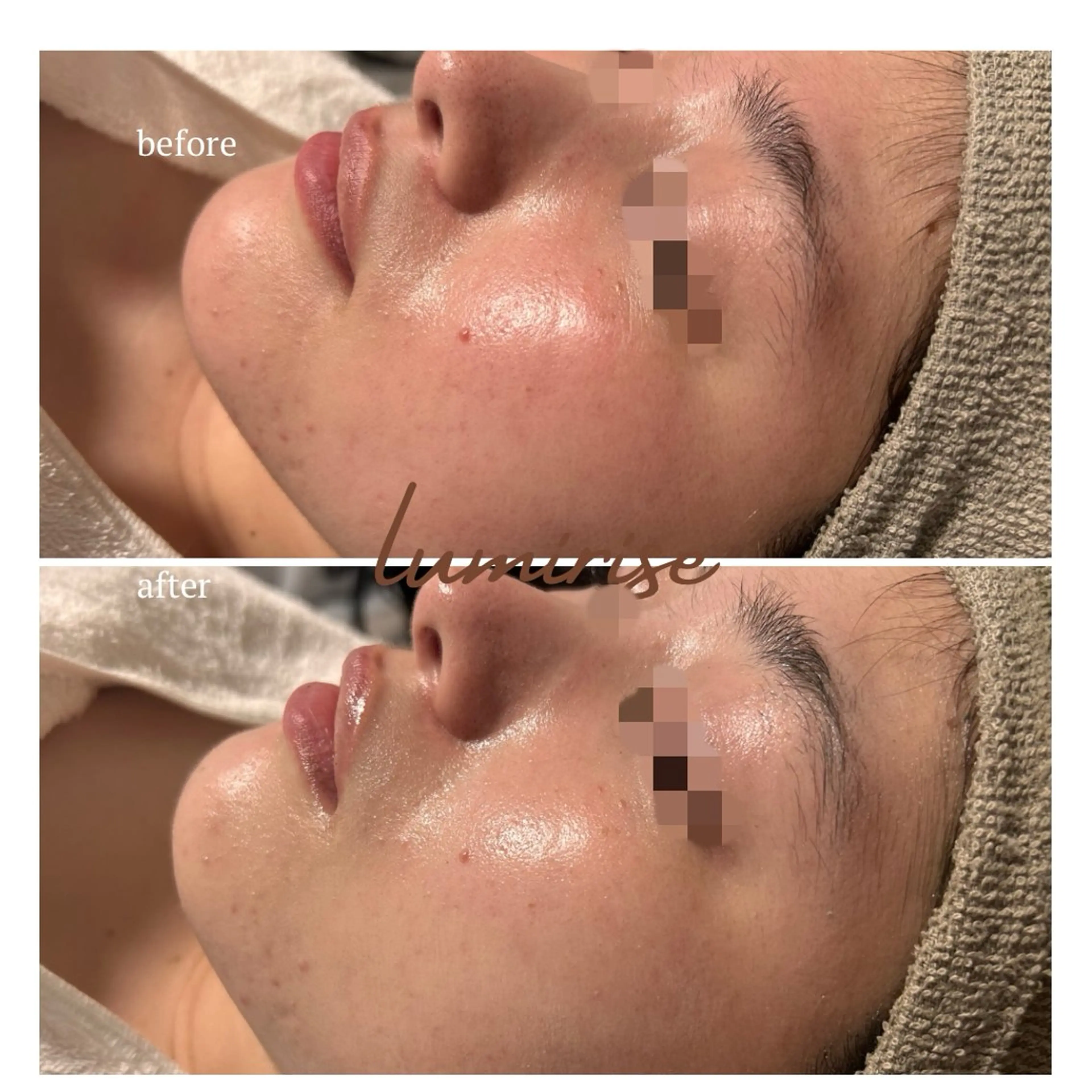 lumirise所属・lumi riseのエステ・リラクイメージ