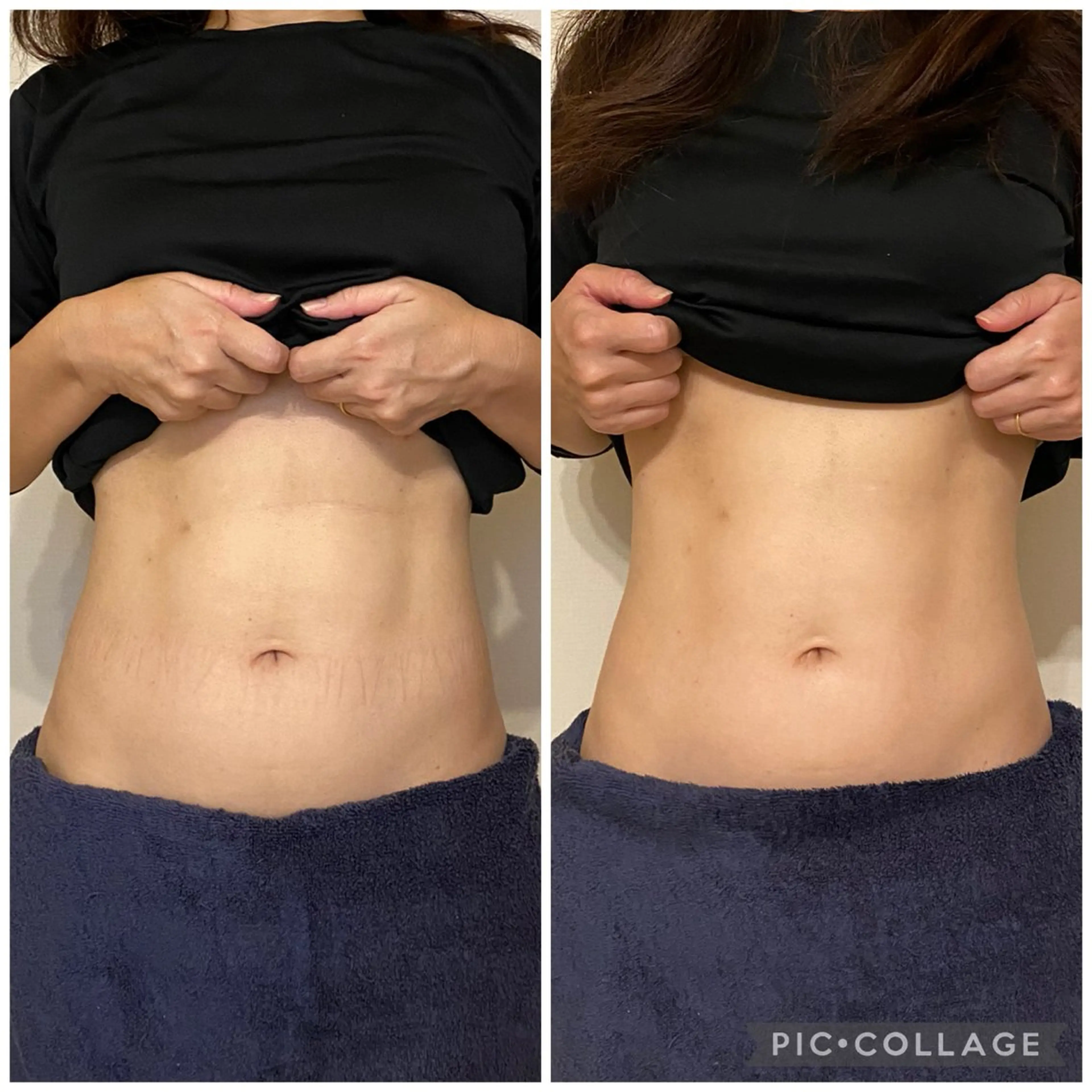 腸セラピーサロン ナチュモアのエステ・リラクイメージ