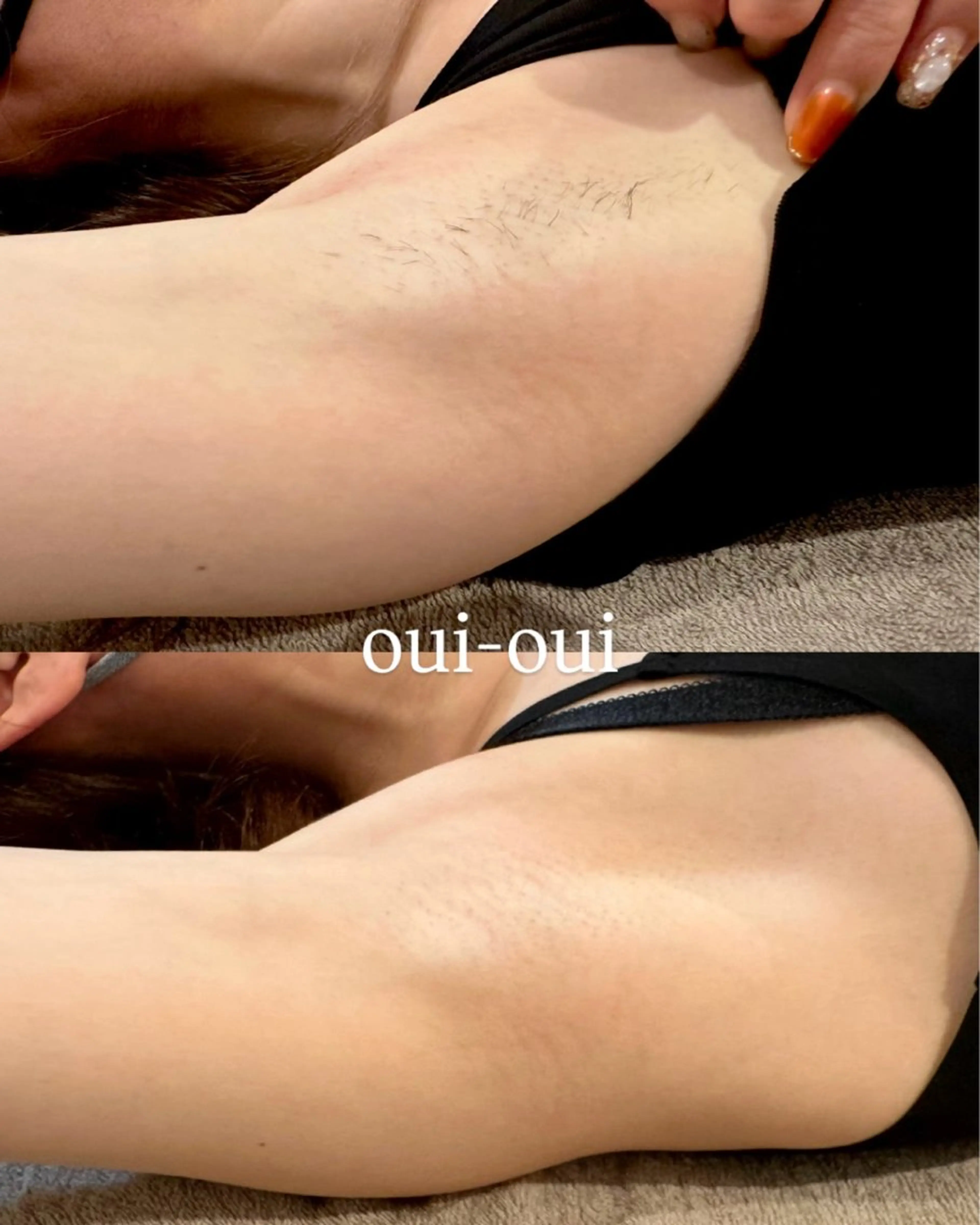 oui-oui　ウィウィ所属・oui-oui 磐田脱毛のエステ・リラクイメージ