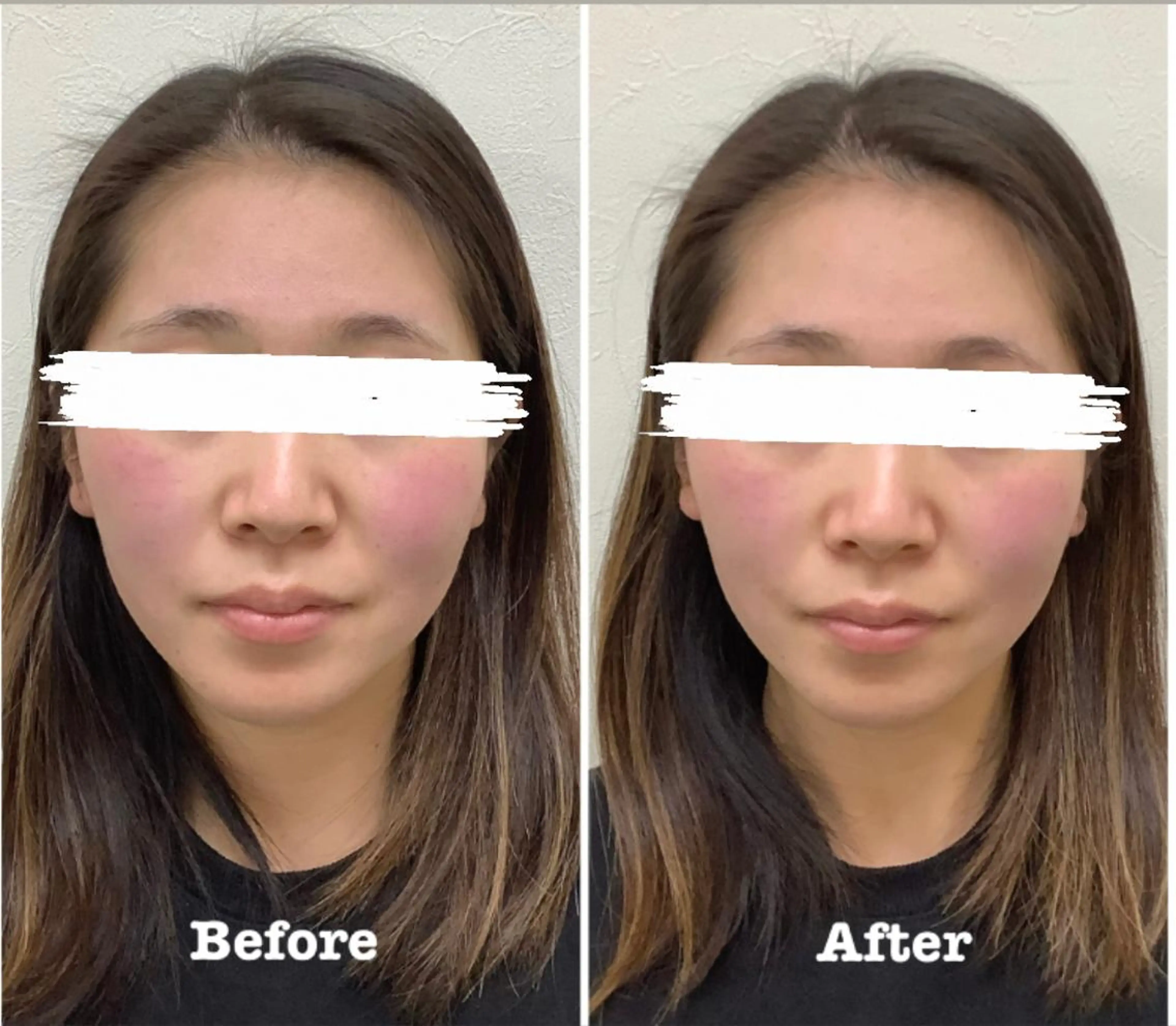 エステ リラク だいち 鍼灸院　伊伝居院のエステ・リラクイメージ