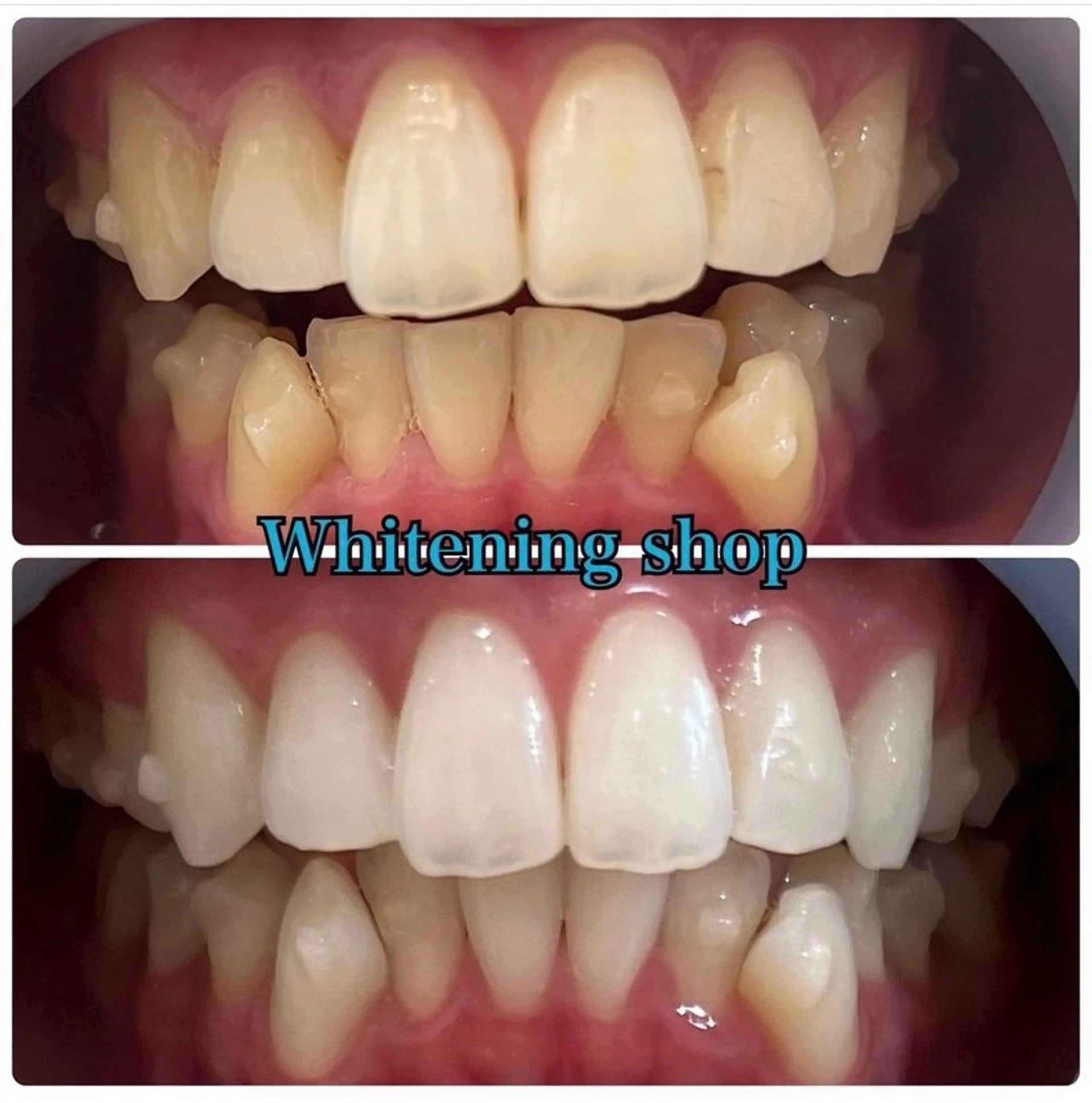 エステ リラク ホワイトニング ショップ吉祥寺店のエステ・リラクイメージ