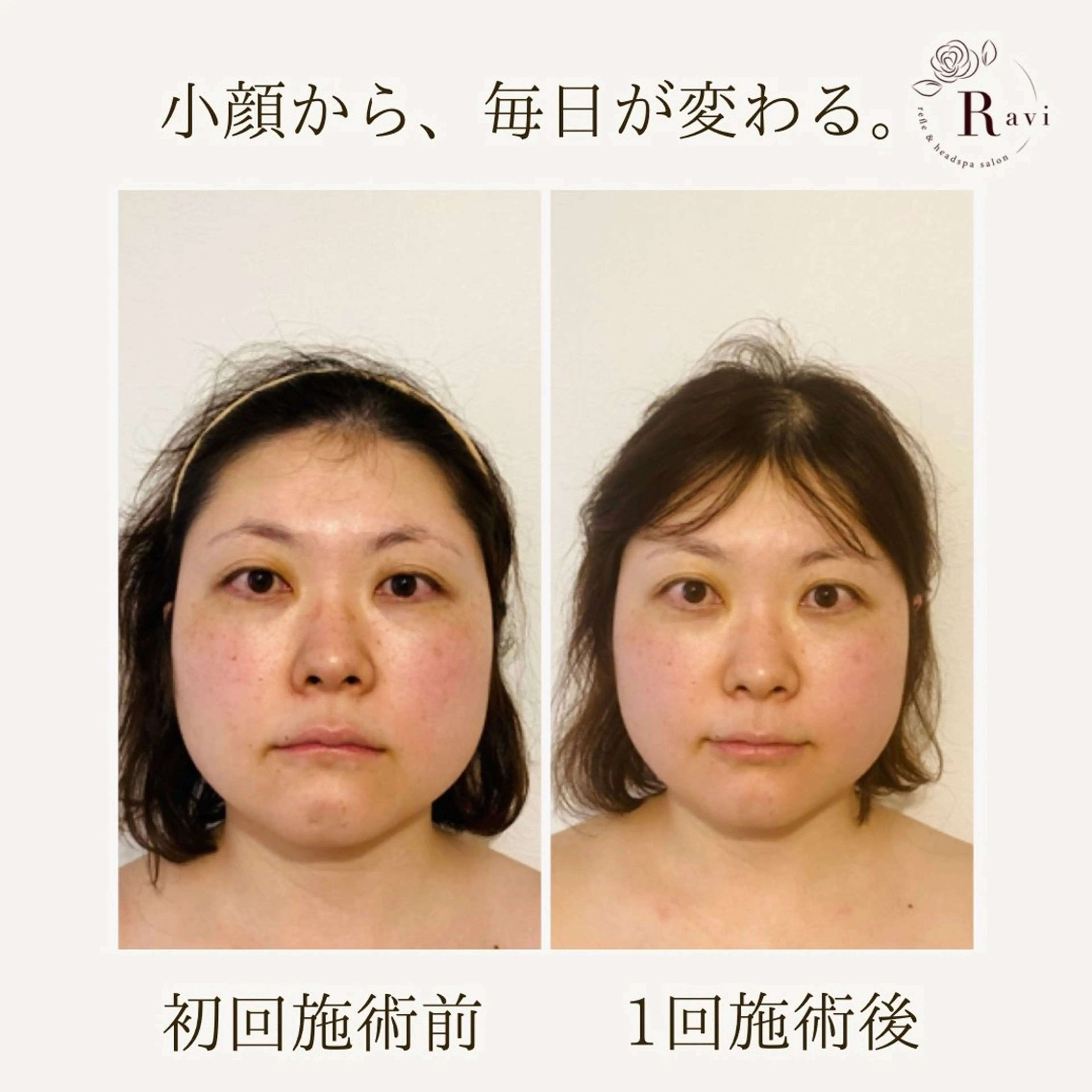 小顔サロンラヴィ　　船橋馬込沢店所属・小顔サロンラヴィ 船橋のエステ・リラクイメージ