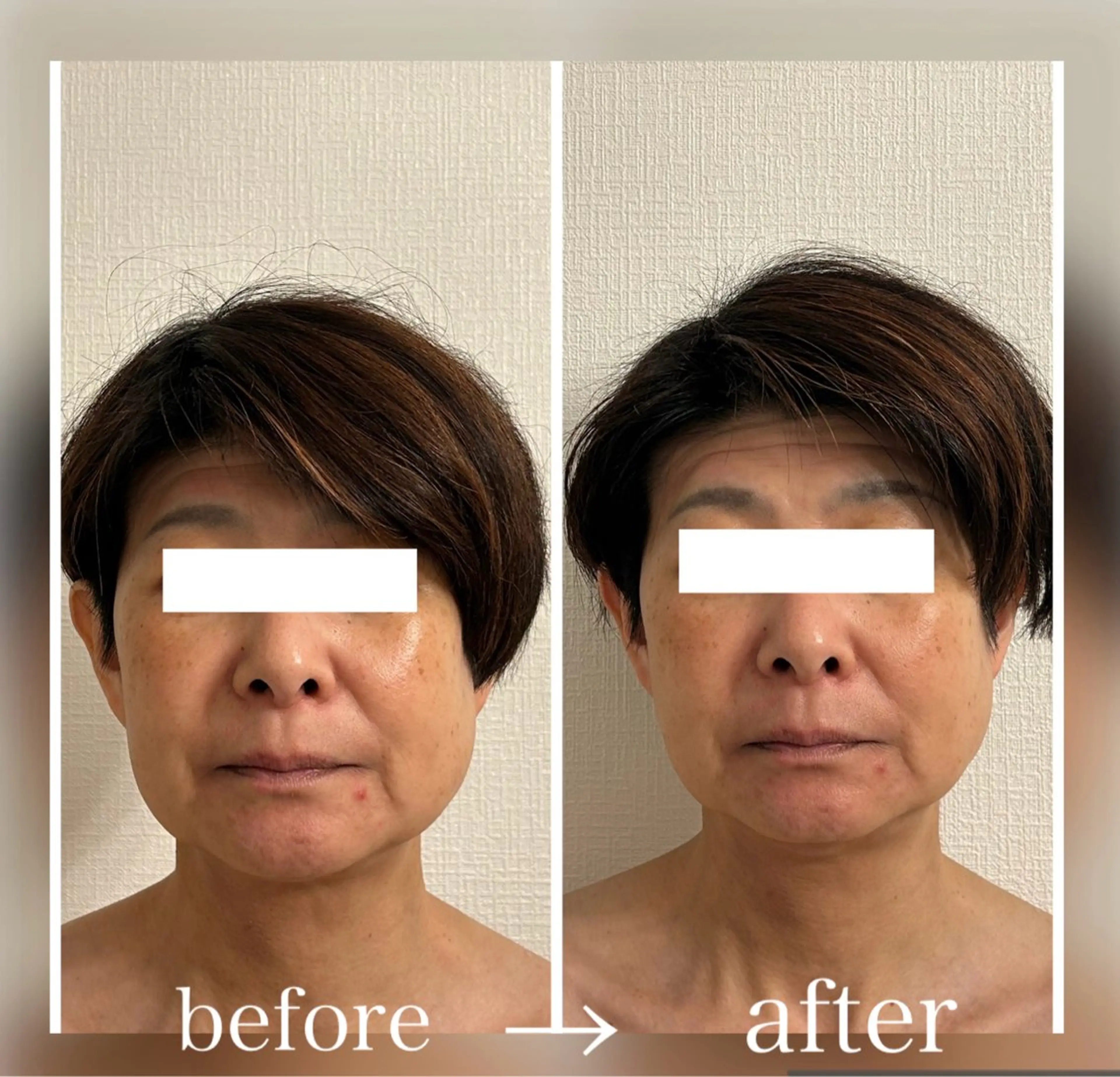 小顔セラピーLIL所属・小顔セラピー LILのエステ・リラクイメージ