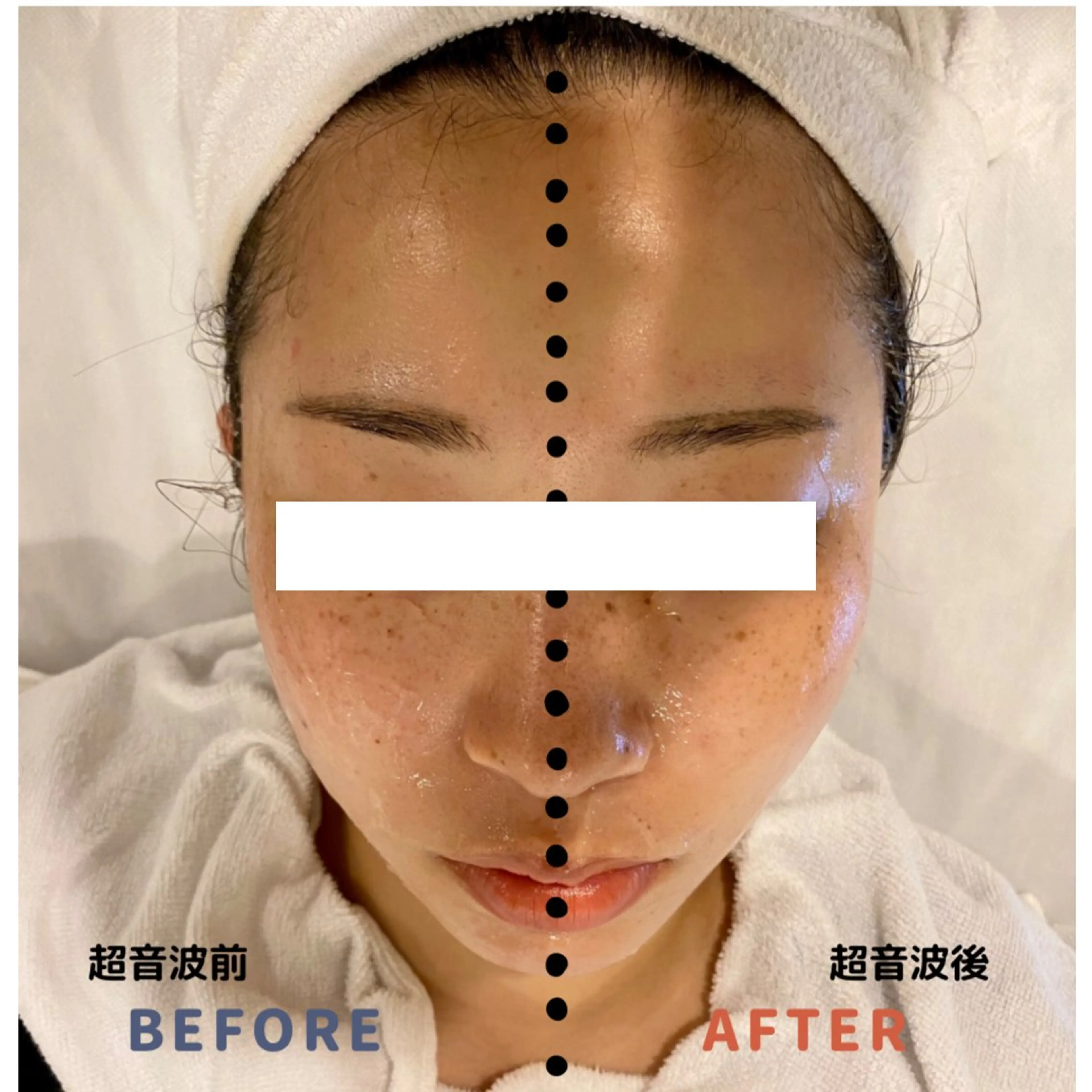 エステと焼き菓子 レモンバームソワンのエステ・リラクイメージ