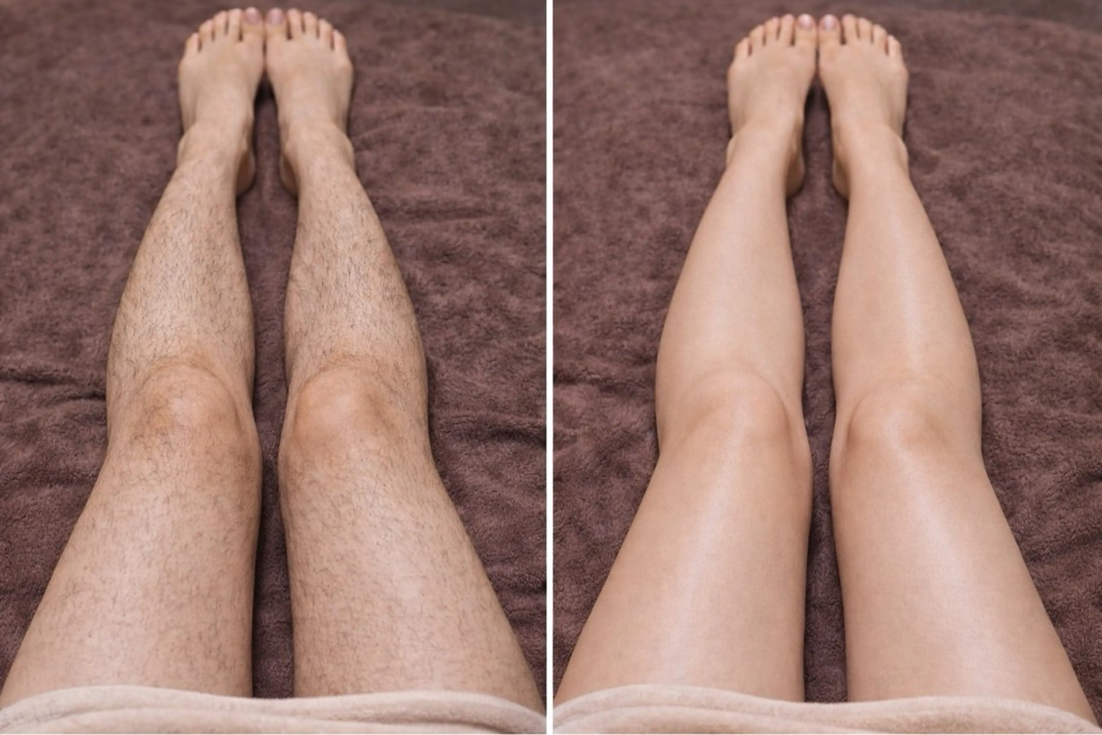 脱毛 脱毛×肌管理サロン ルネルのエステ・リラクイメージ