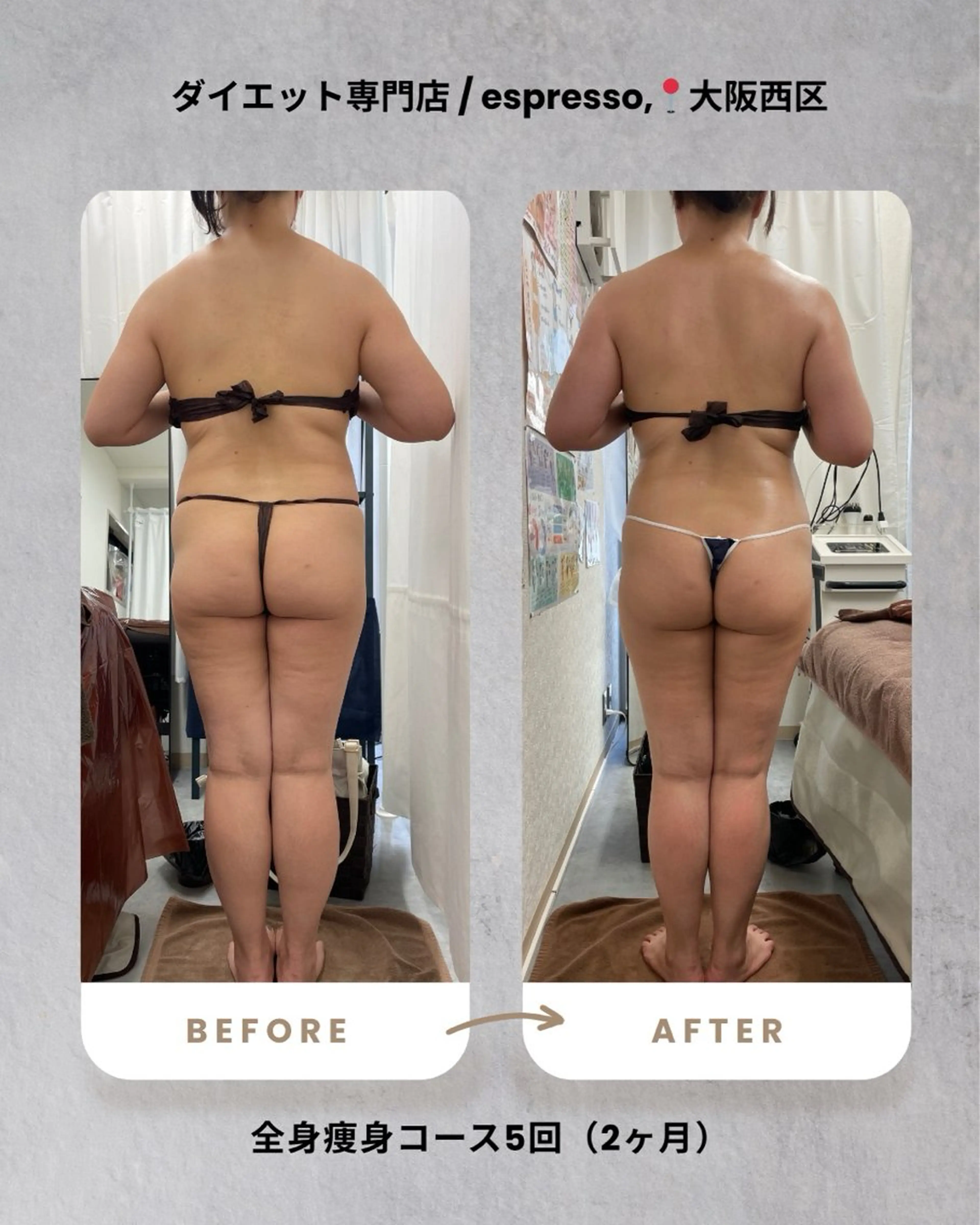 エステ リラク espresso,所属・《痩身、小顔専門店》 エスプレッソのエステ・リラクイメージ