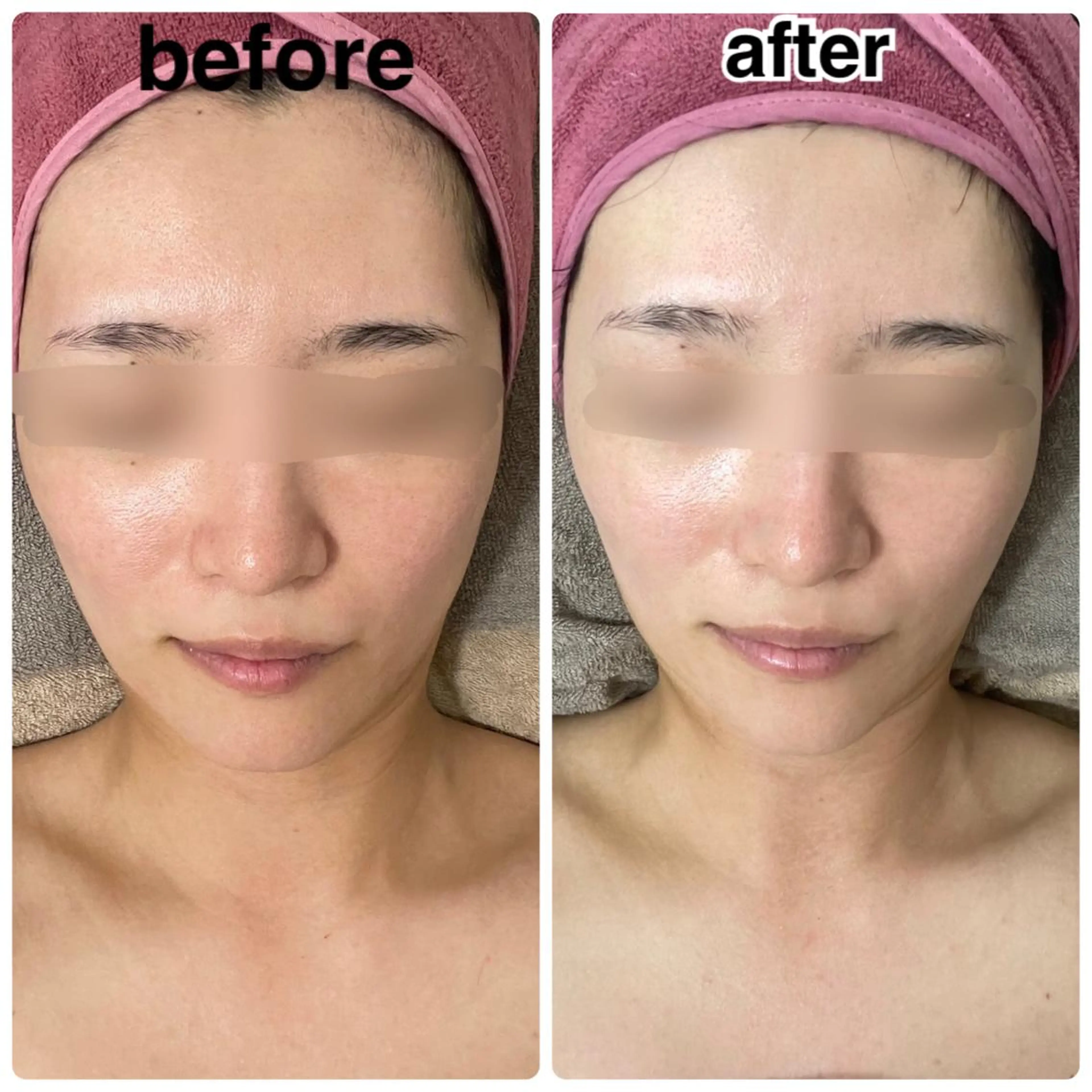 エステ リラク ボディ&フェイシャルサロン SHINE-シャイン-所属・ボディ&フェイシャル サロンSHINEのエステ・リラクイメージ