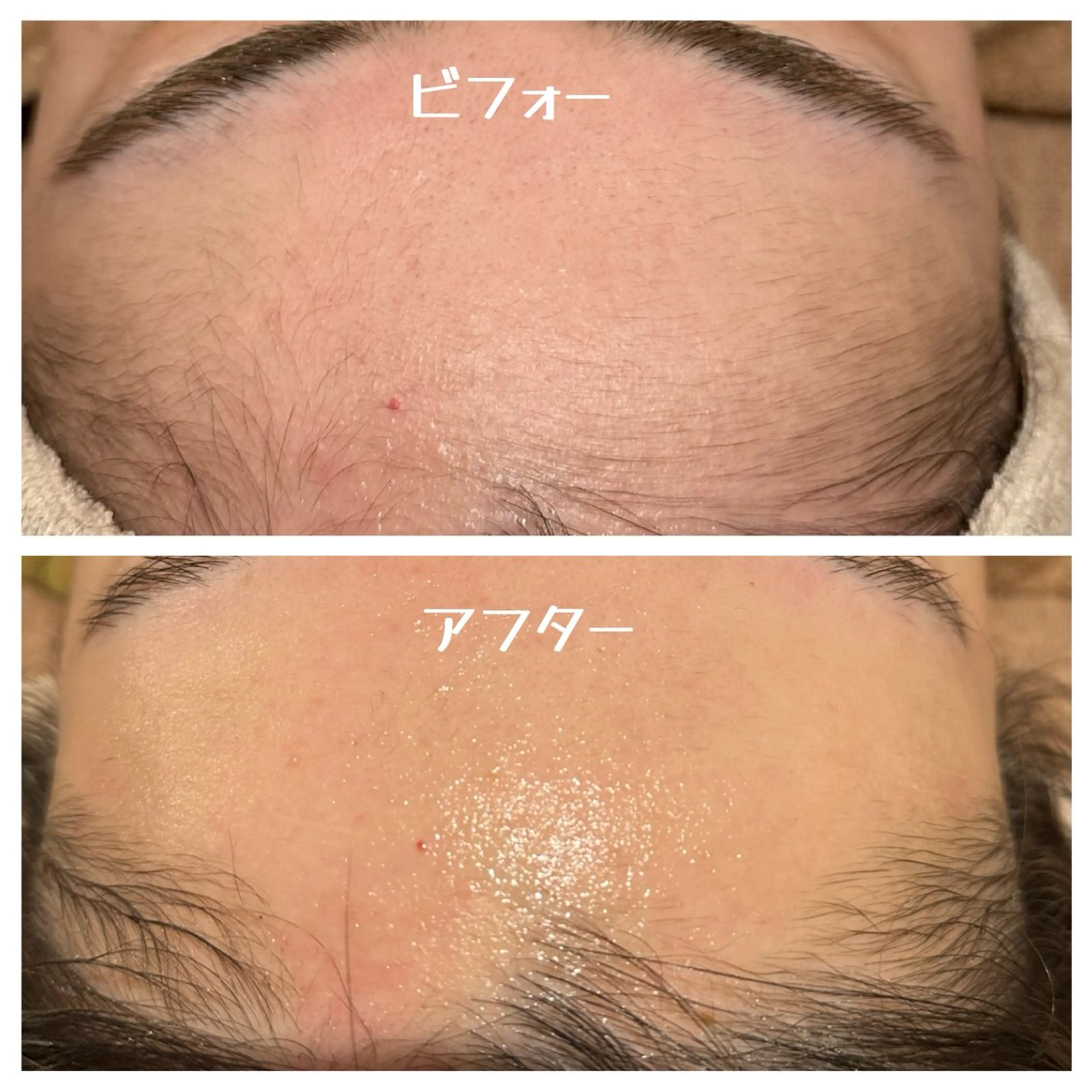 フェイスWaxの写真