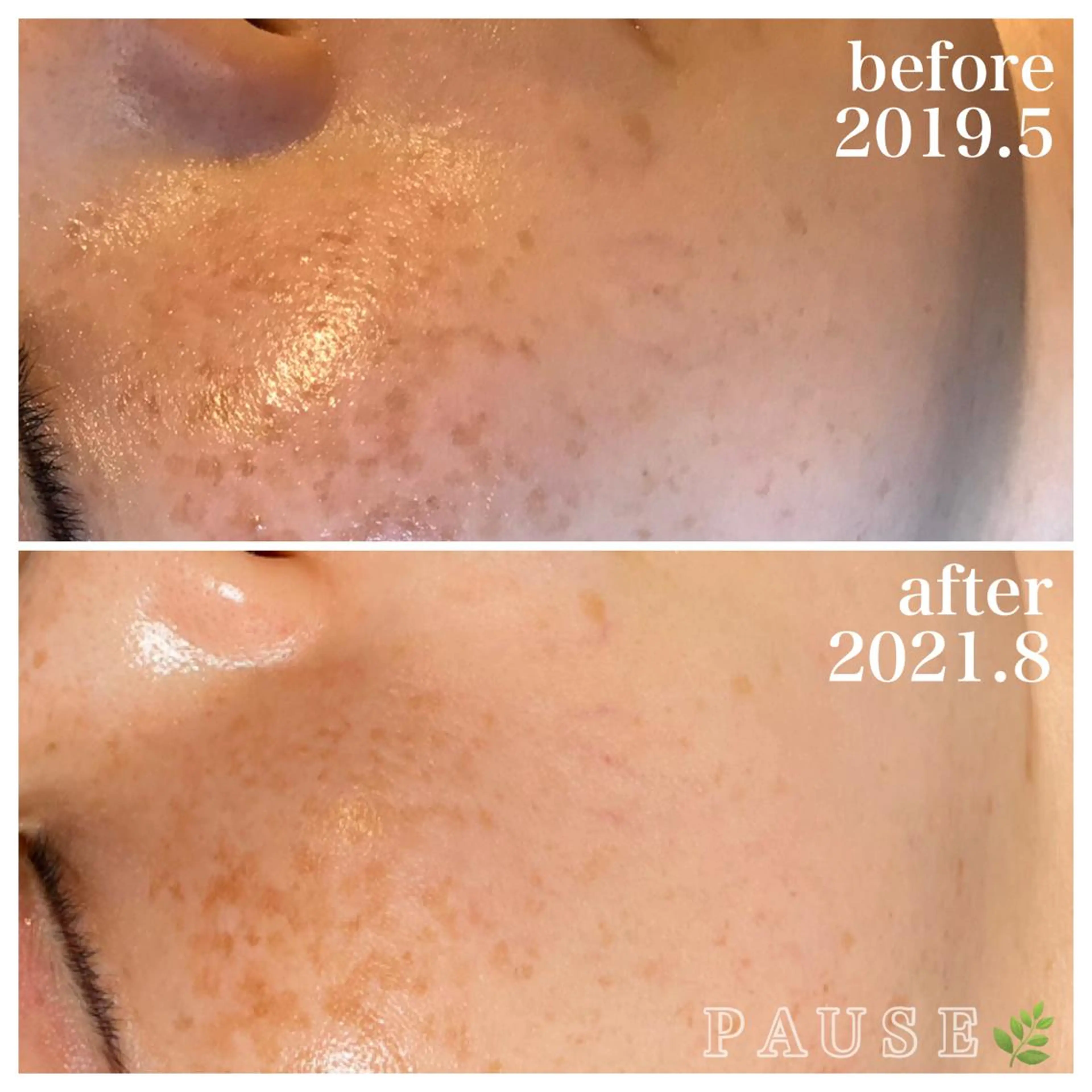 エステ リラク 浜野 恵美のエステ・リラクイメージ