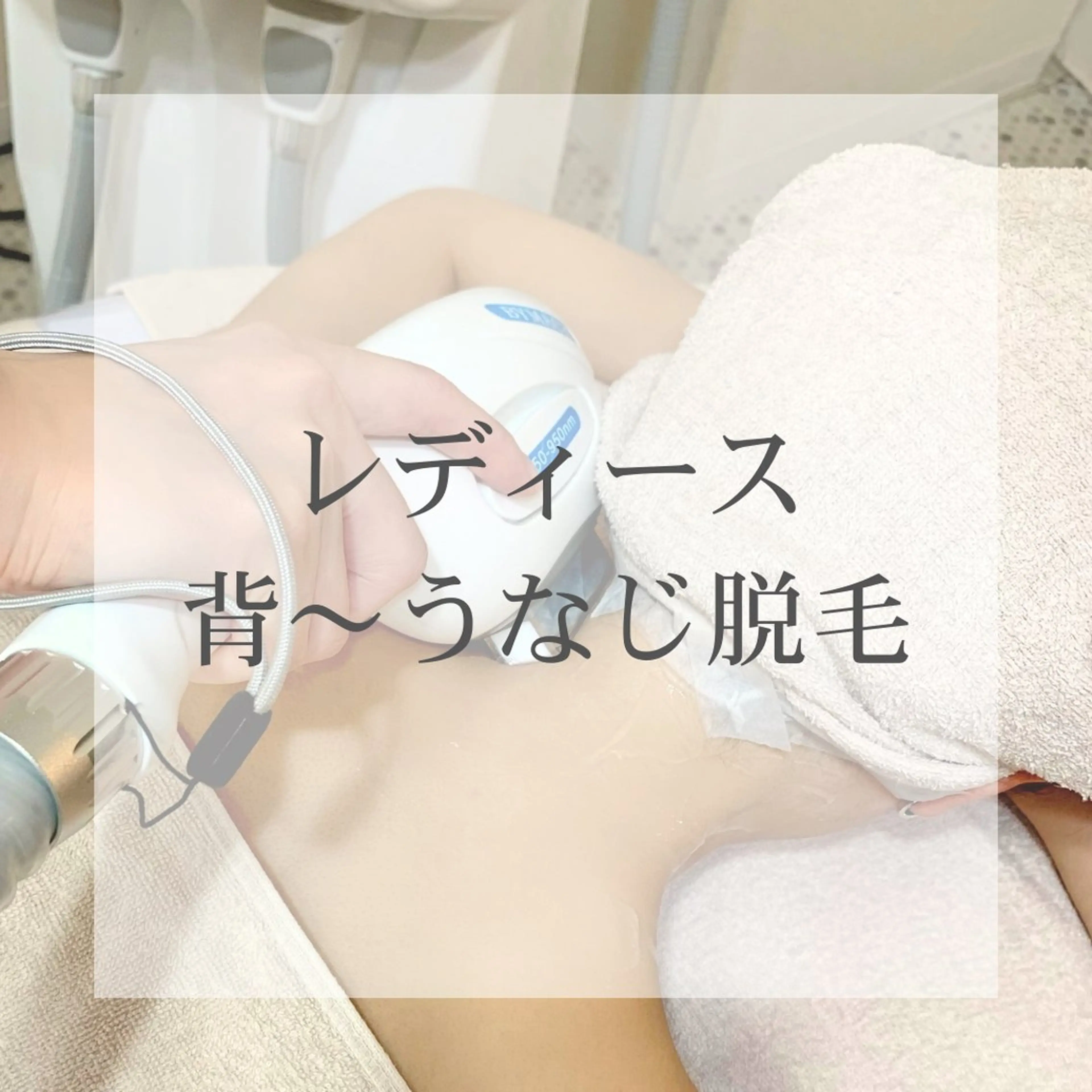 レディース|背中上下​〜​うなじ脱毛(シェービング込み)の写真