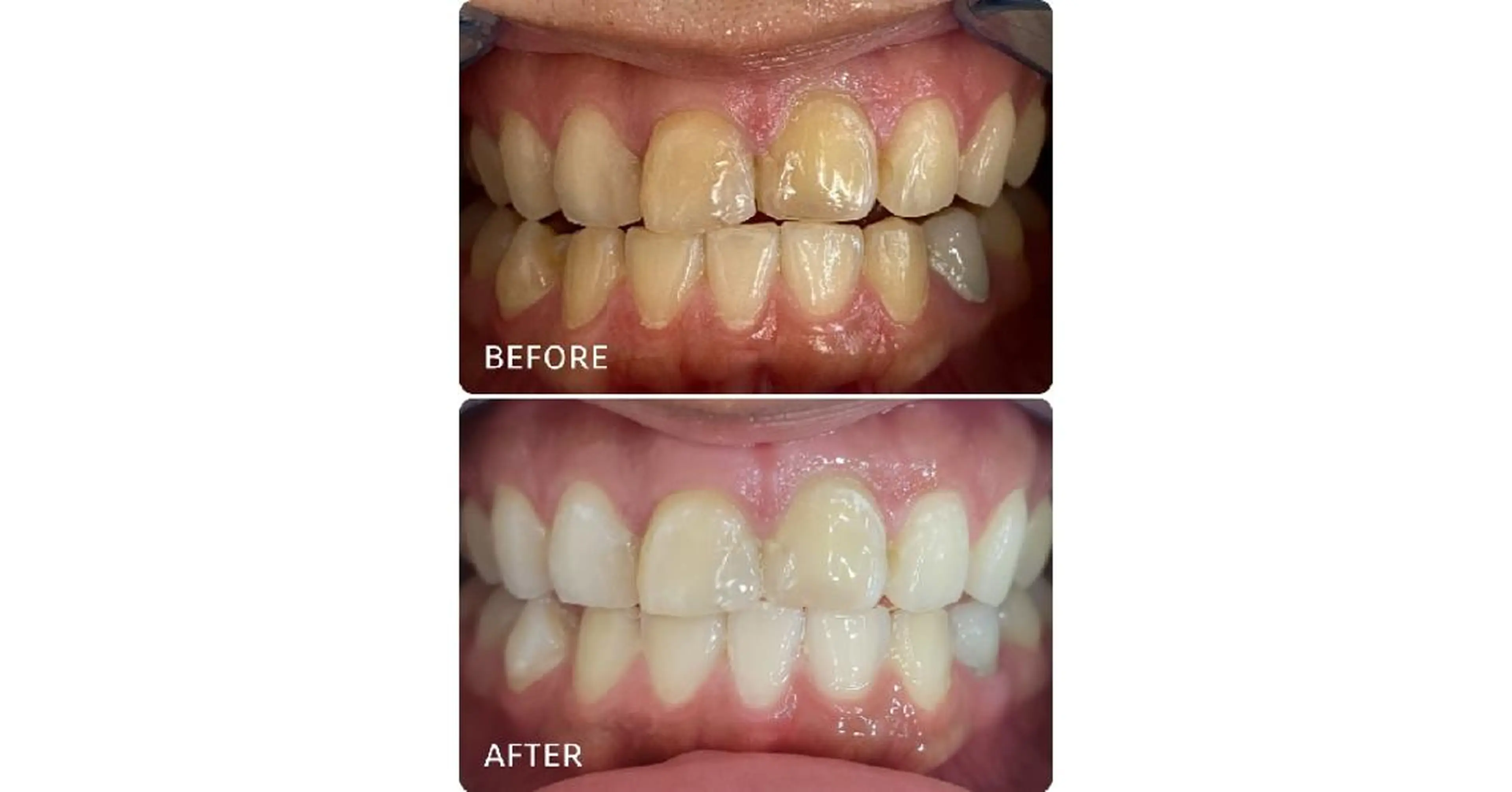 ホワイトニングサロン ラウレアのその他イメージ