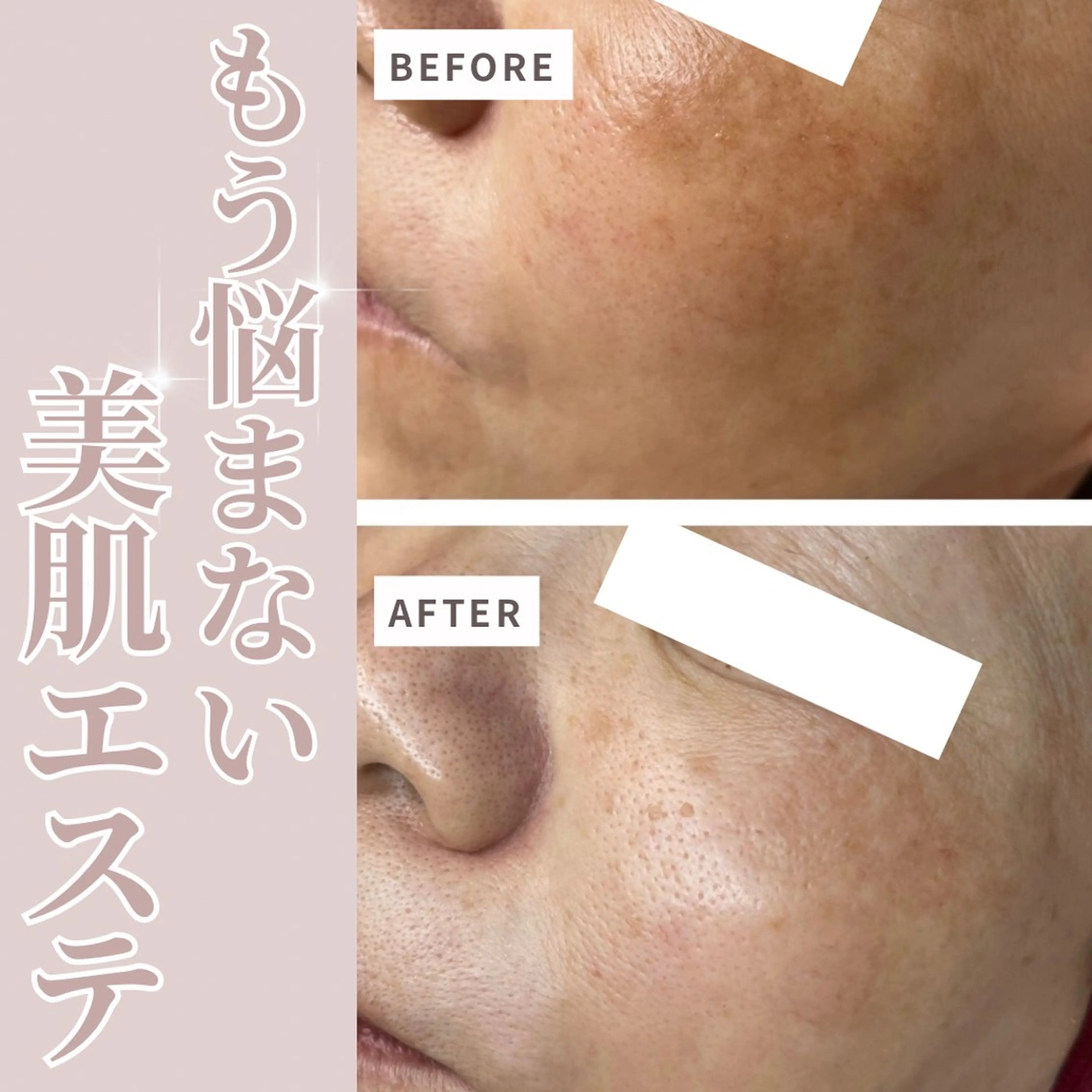 エステ 伊藤 稚菜のエステ・リラクイメージ