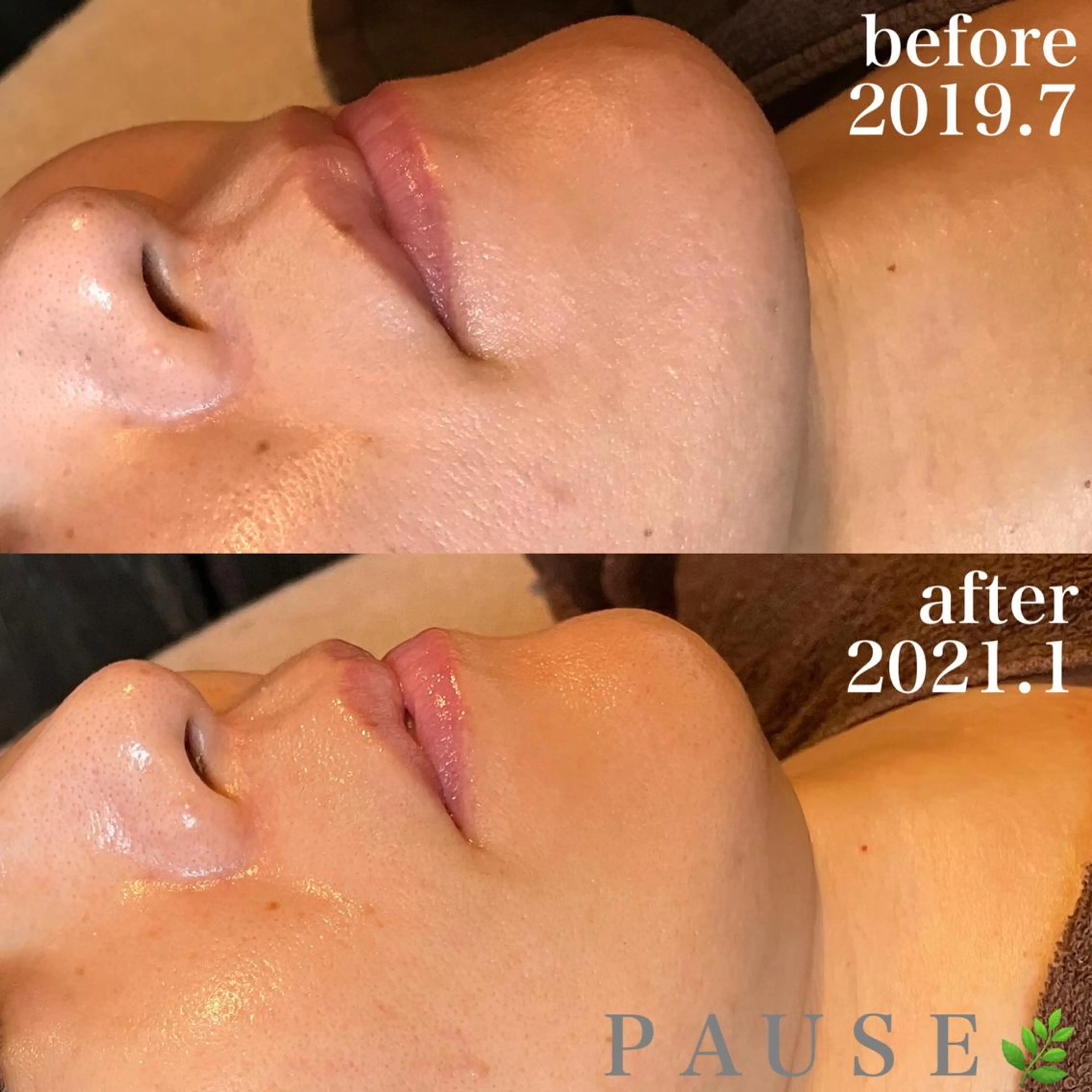 エステ 浜野 恵美のエステ・リラクイメージ