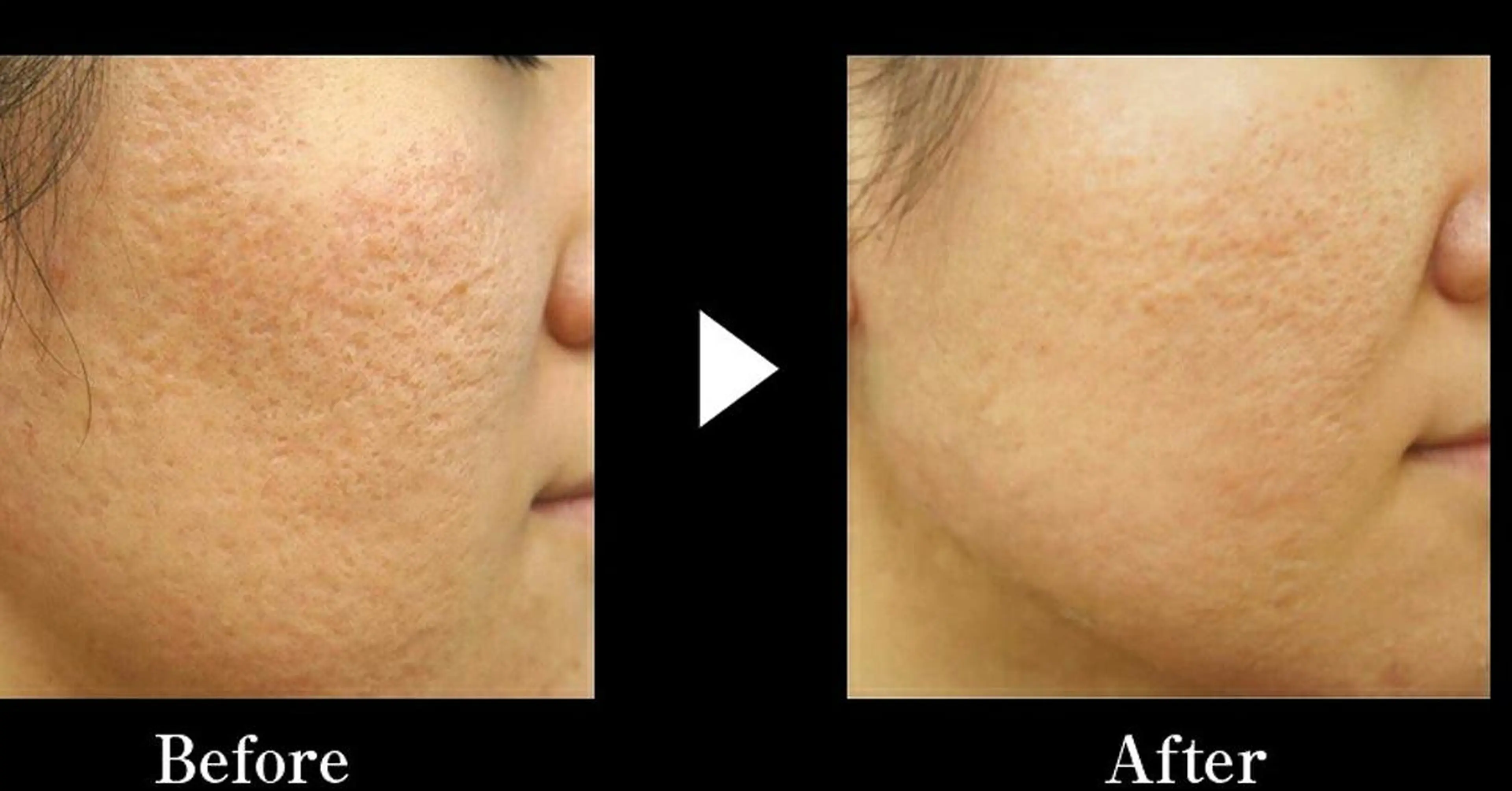 マツエク・マツパ メンズ キッズ ロング カラー ショート ミディアム セミロング パーマ ネイル ヘアアレンジ 次世代まつげパーマは 『リベル名古屋』のマツエク・マツパデザイン