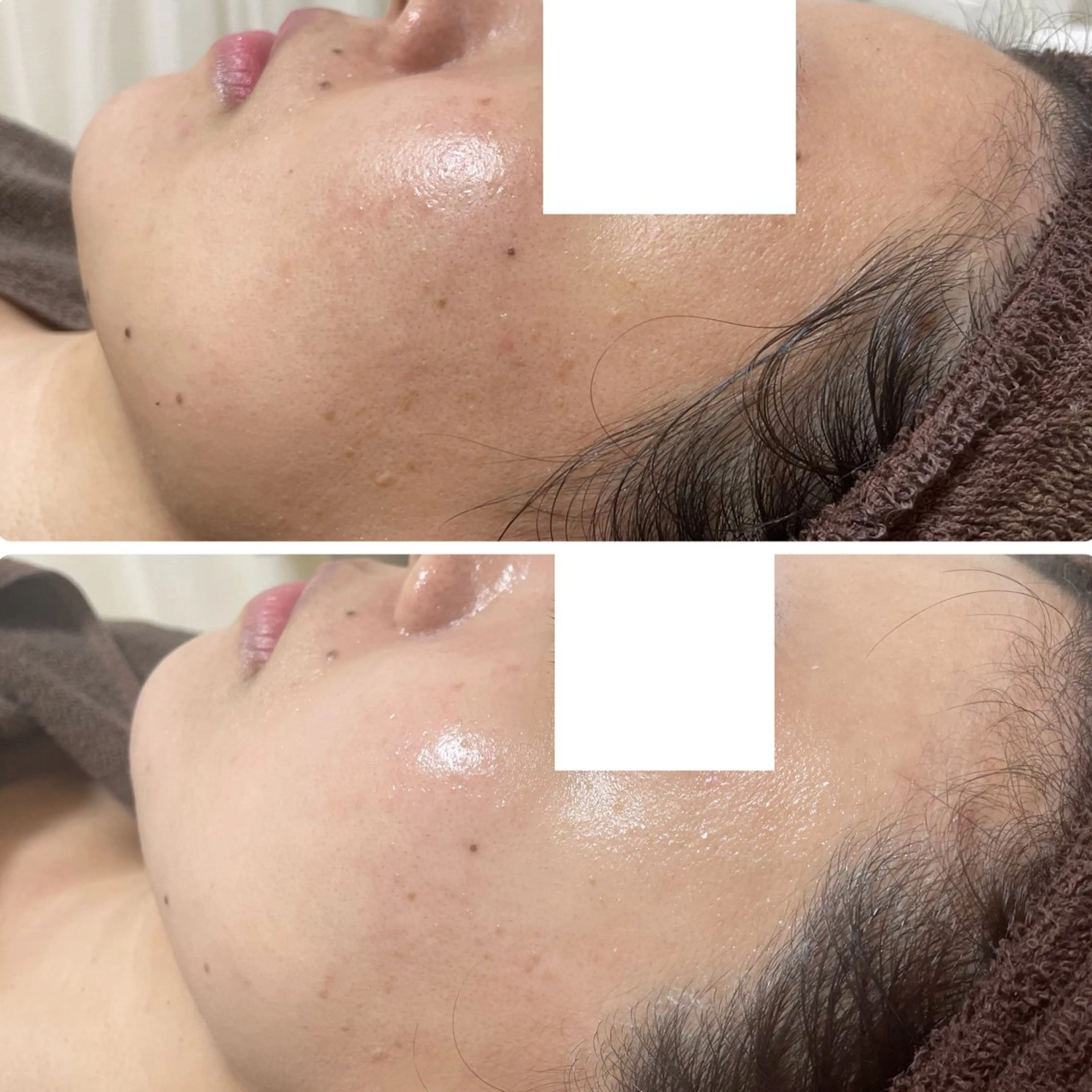 エステ 肌質改善サロン La Divinaのエステ・リラクイメージ