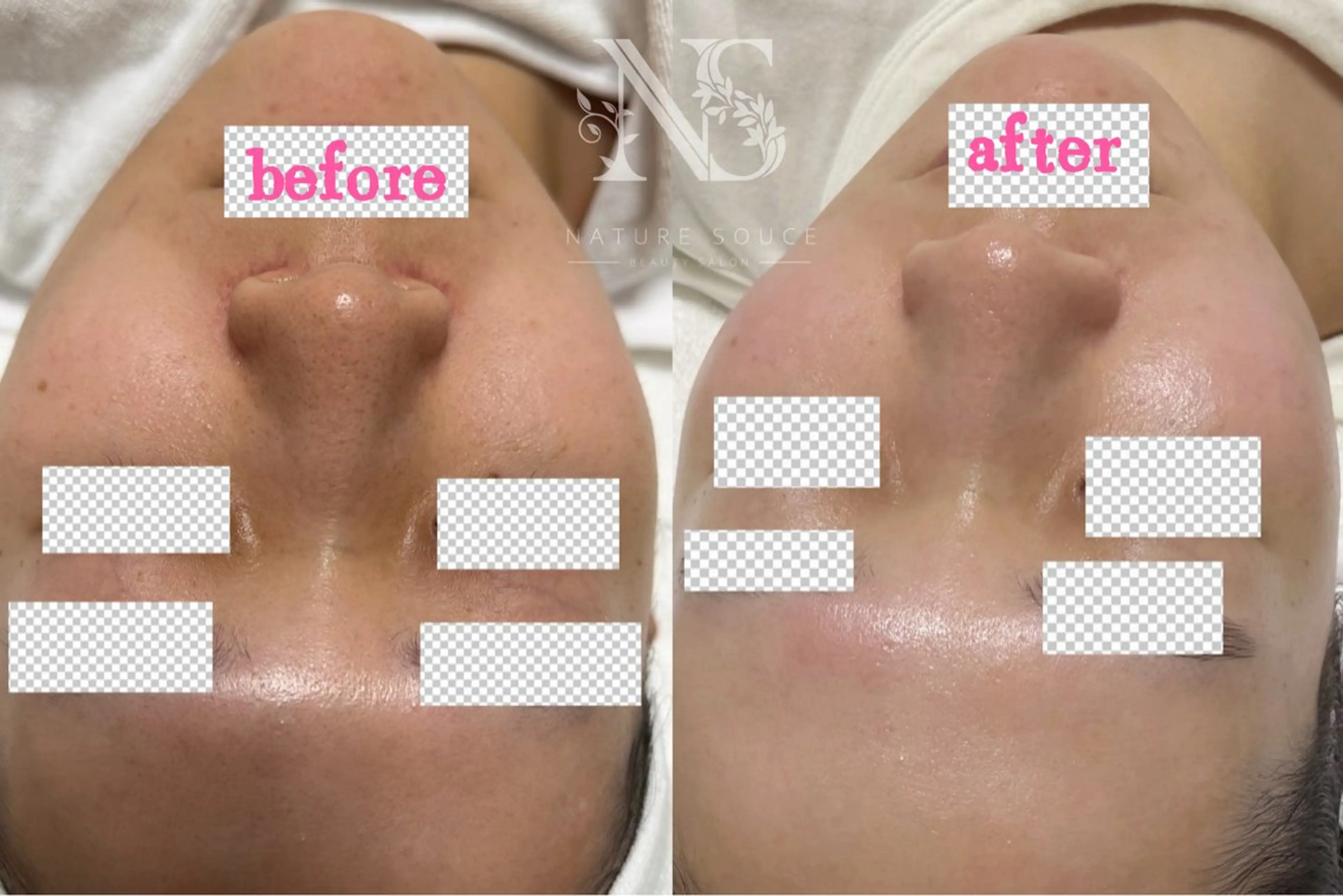 その他 Nature Souce毛穴専門店のその他イメージ