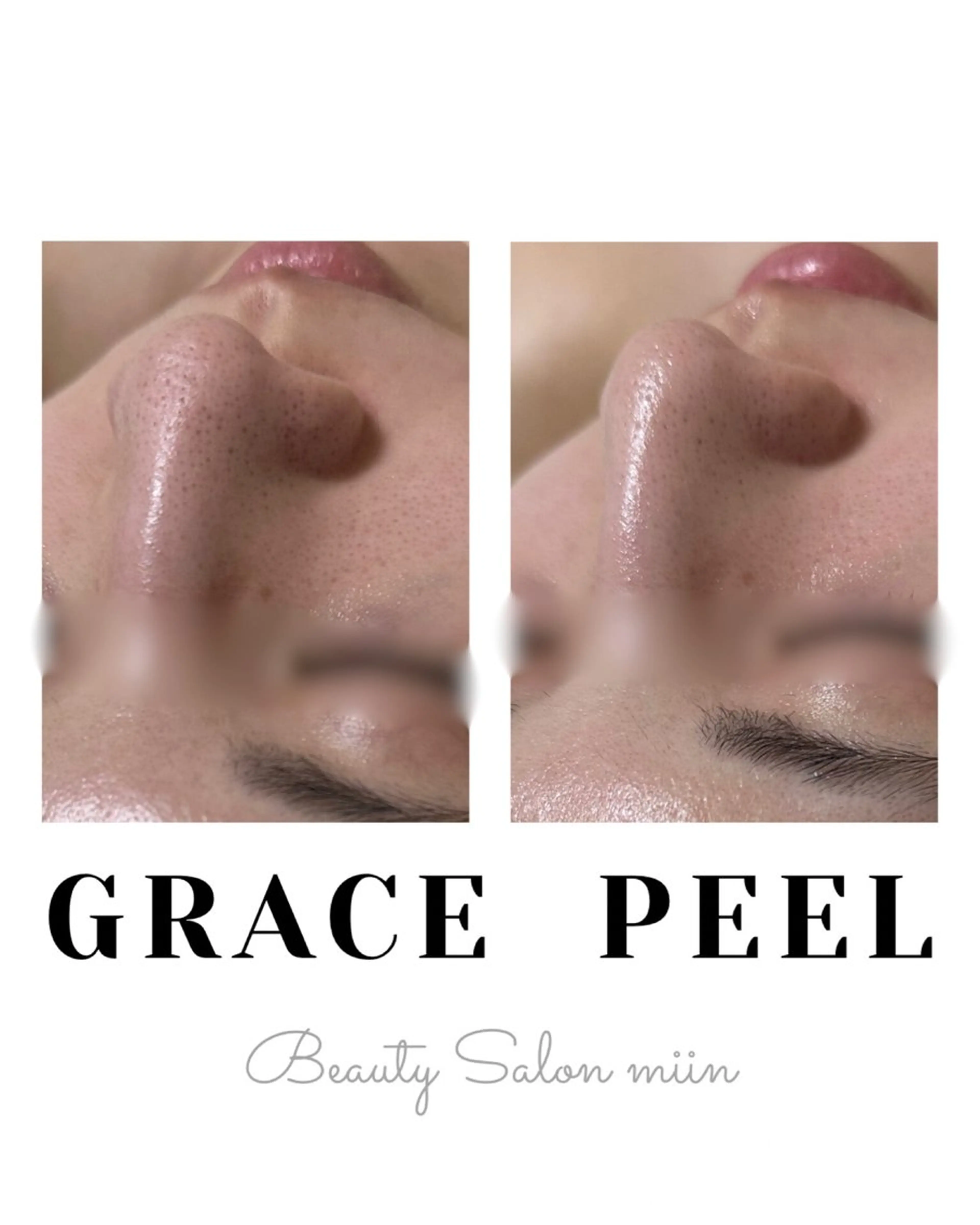 エステ 韓国肌管理 白玉肌管理®︎のエステ・リラクイメージ