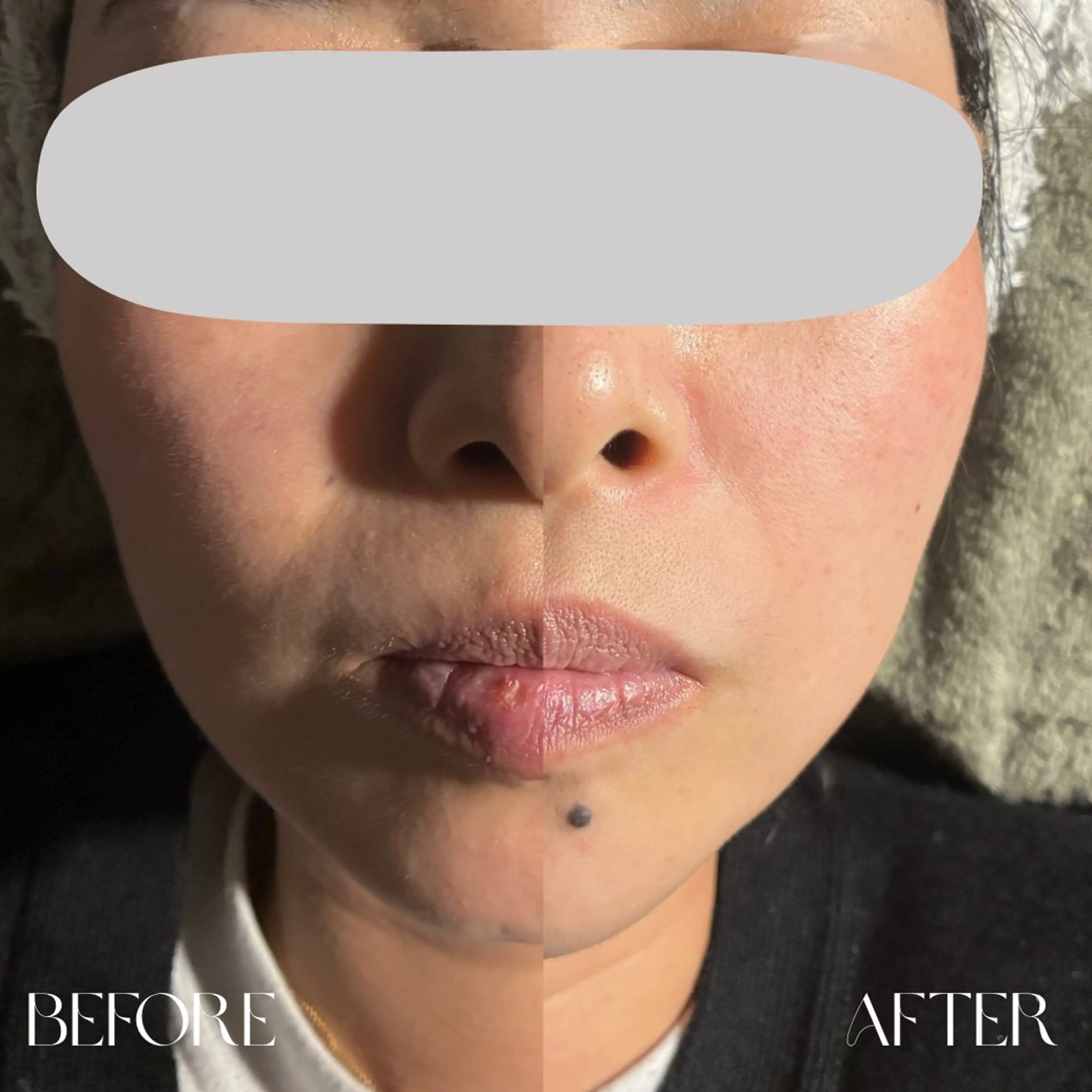 エステ nail salon cherianのネイルデザイン