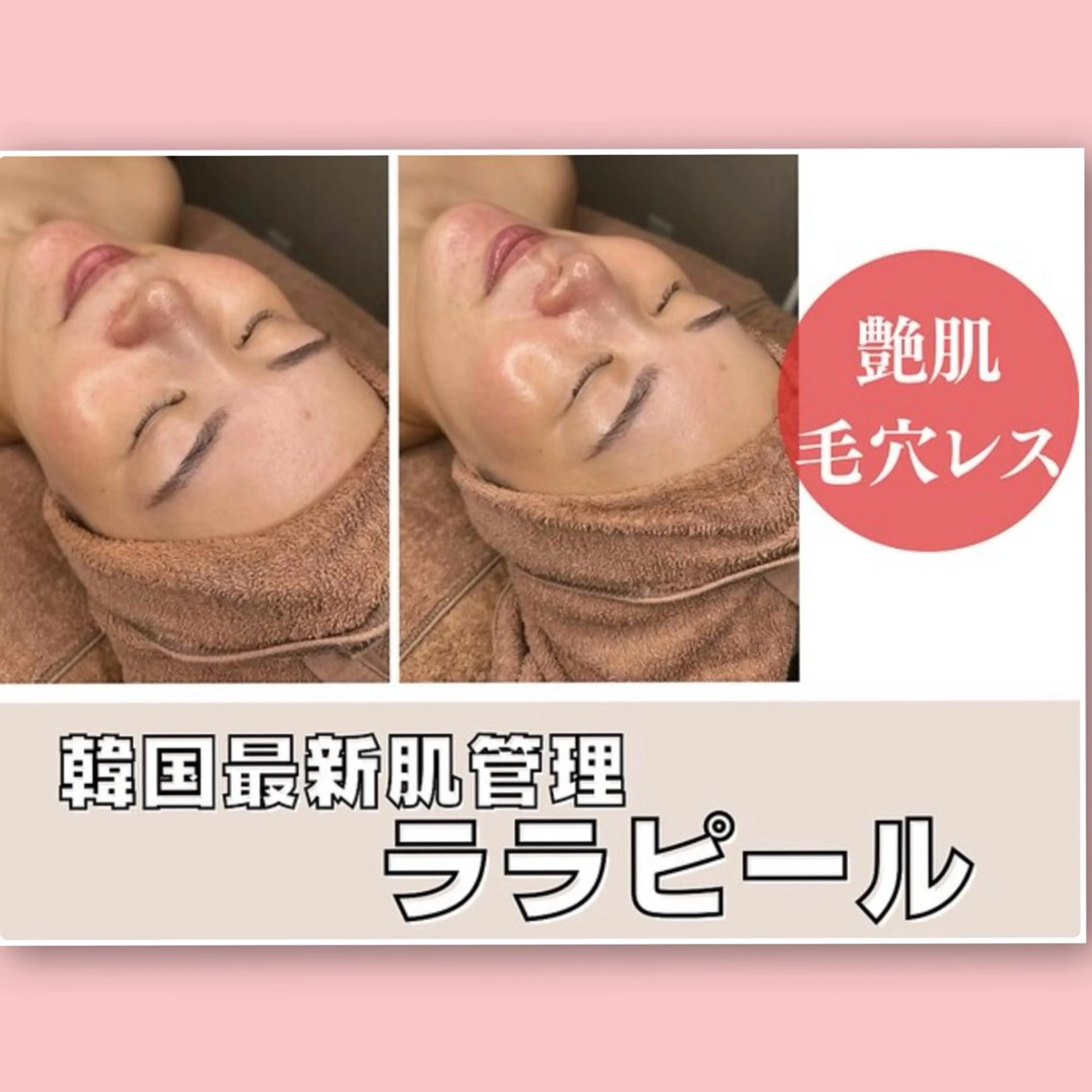 【SNSで話題】憧れの韓国肌に♪水光肌艶ララピール(ララ専用ゲルマスクのお仕上げ付き)の写真