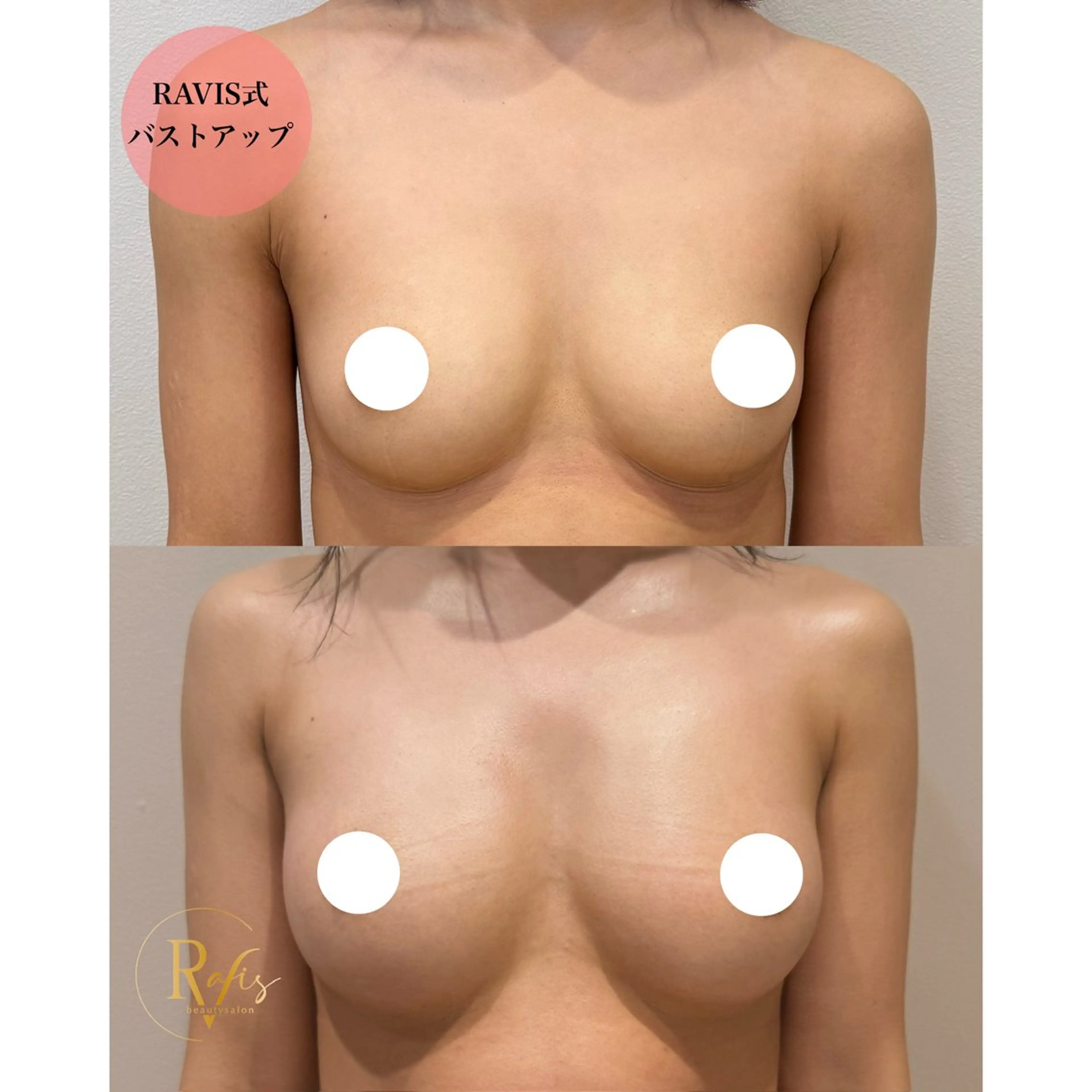 【バストアップモニター募集‼️】感動ふわふわバストへボリュームアップ💕下記詳細お読みください↓の写真