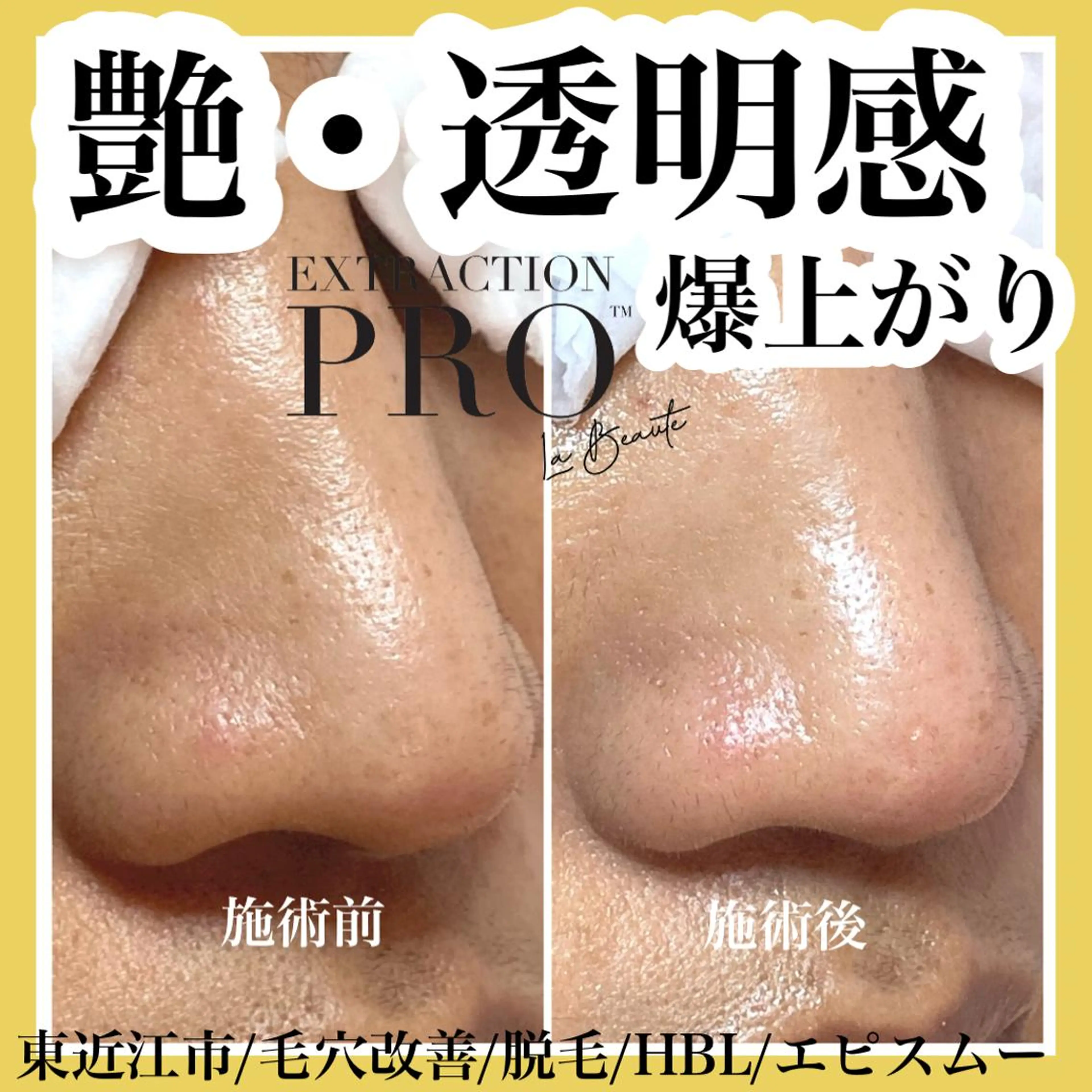 epismoo 脱毛/HBL/毛穴の眉毛・アイブロウイメージ