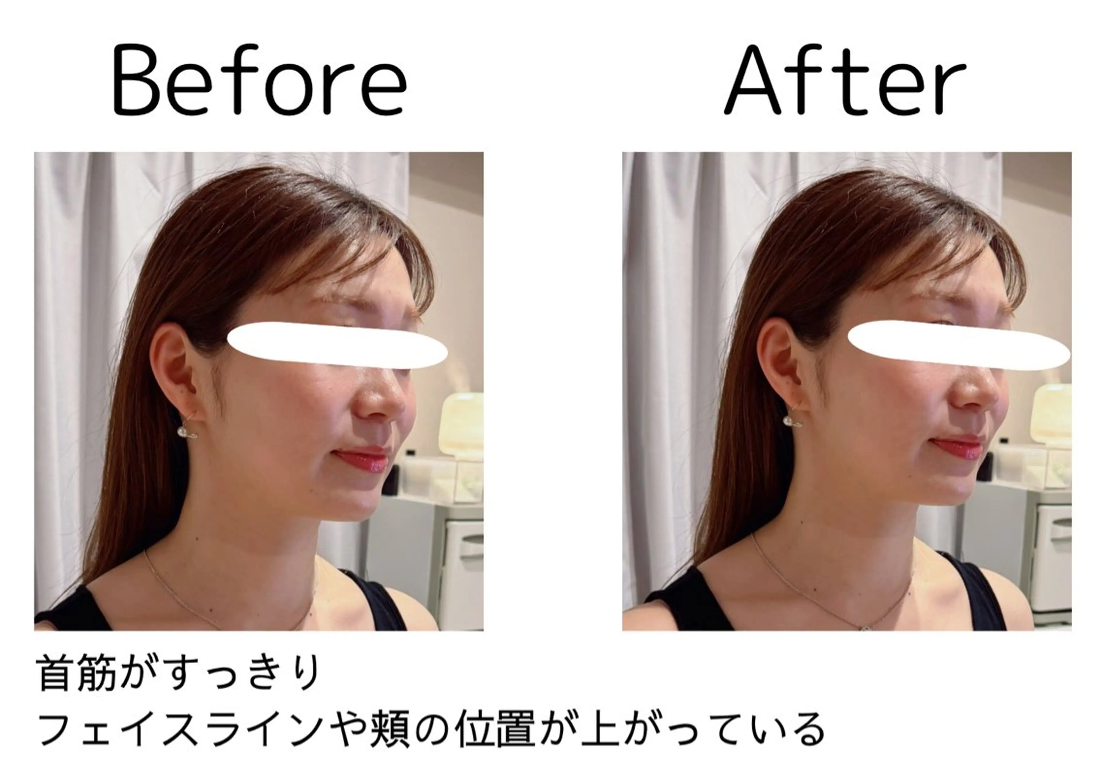 鍼灸院olina所属・鍼灸師 NARUMIのエステ・リラクイメージ