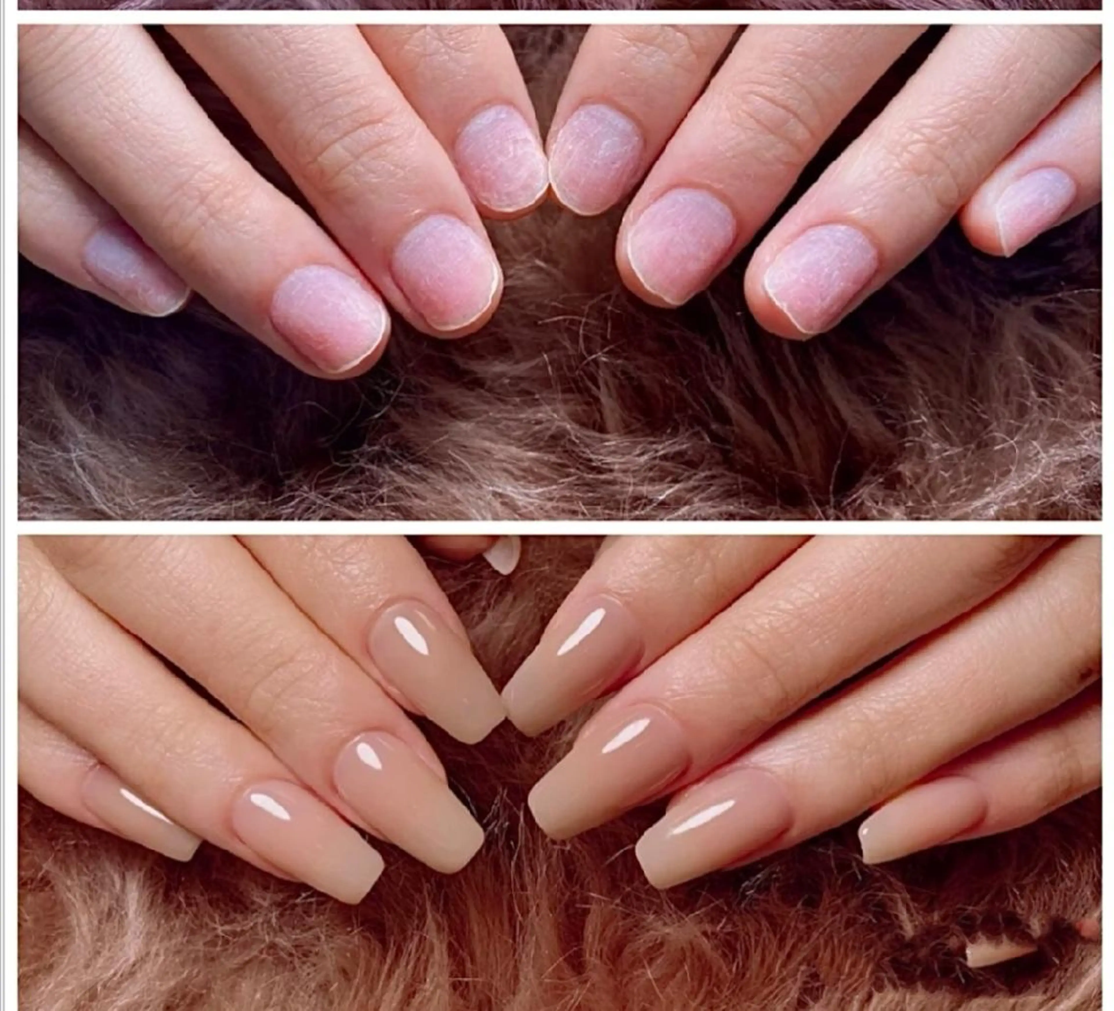 ミディアム ネイル ネイリストゆか💅 長さだし、深爪矯正のネイルデザイン