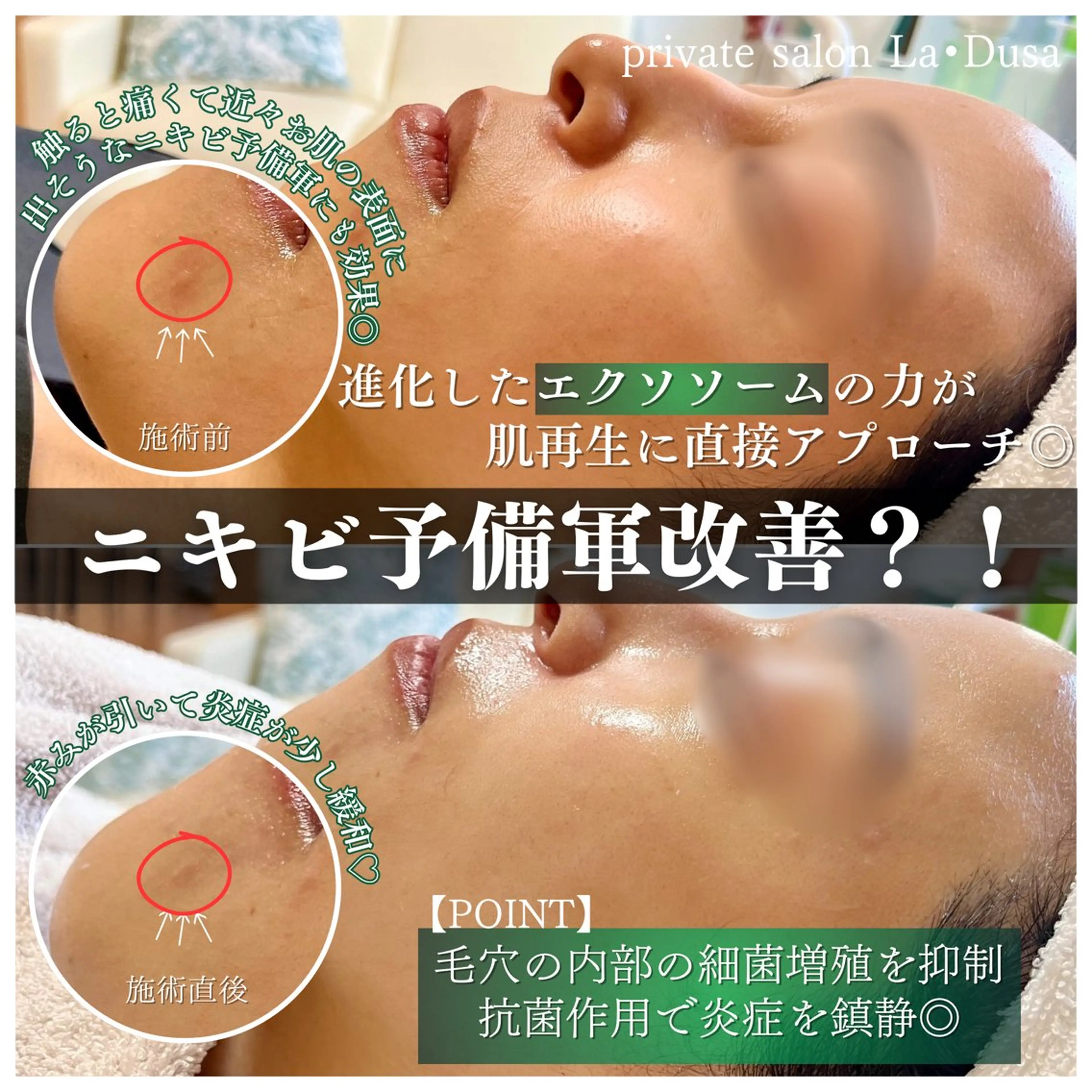 エステ リラク La Dusa 韓国肌管理/小波のエステ・リラクイメージ