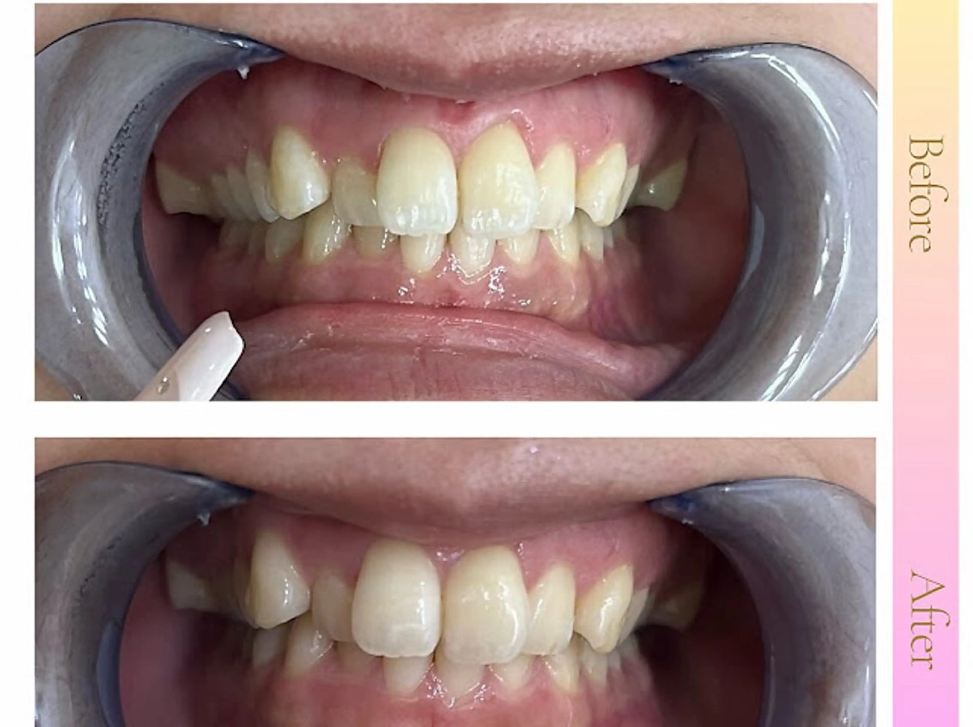 エステ リラク エクシア町田店所属・miku .のエステ・リラクイメージ