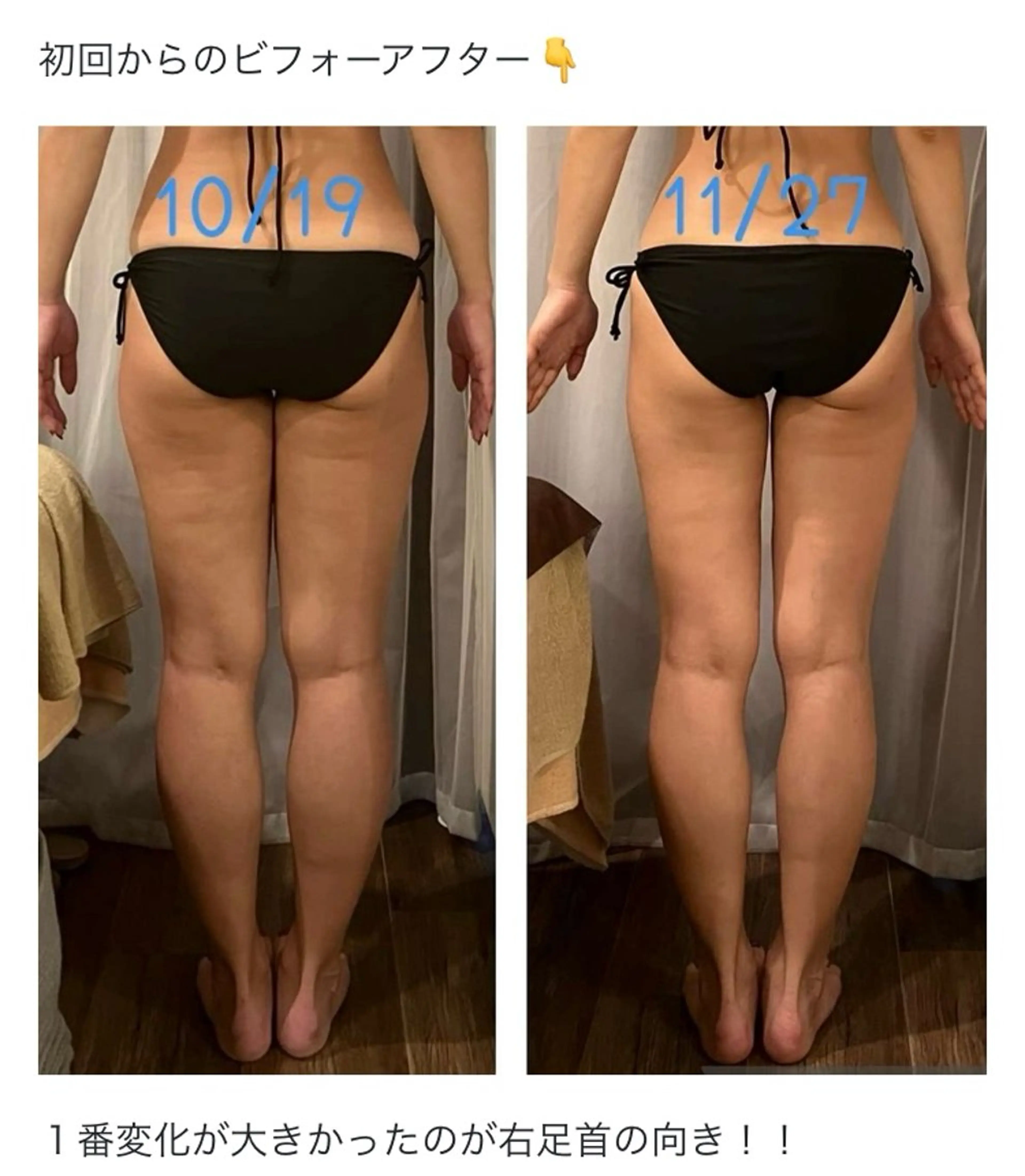 ✴︎究極の美脚✴︎ スッキリ太もも、細くなるふくらはぎ、浮腫み、セルライト、O脚解決　ヘッドスパ付　特別割引の写真