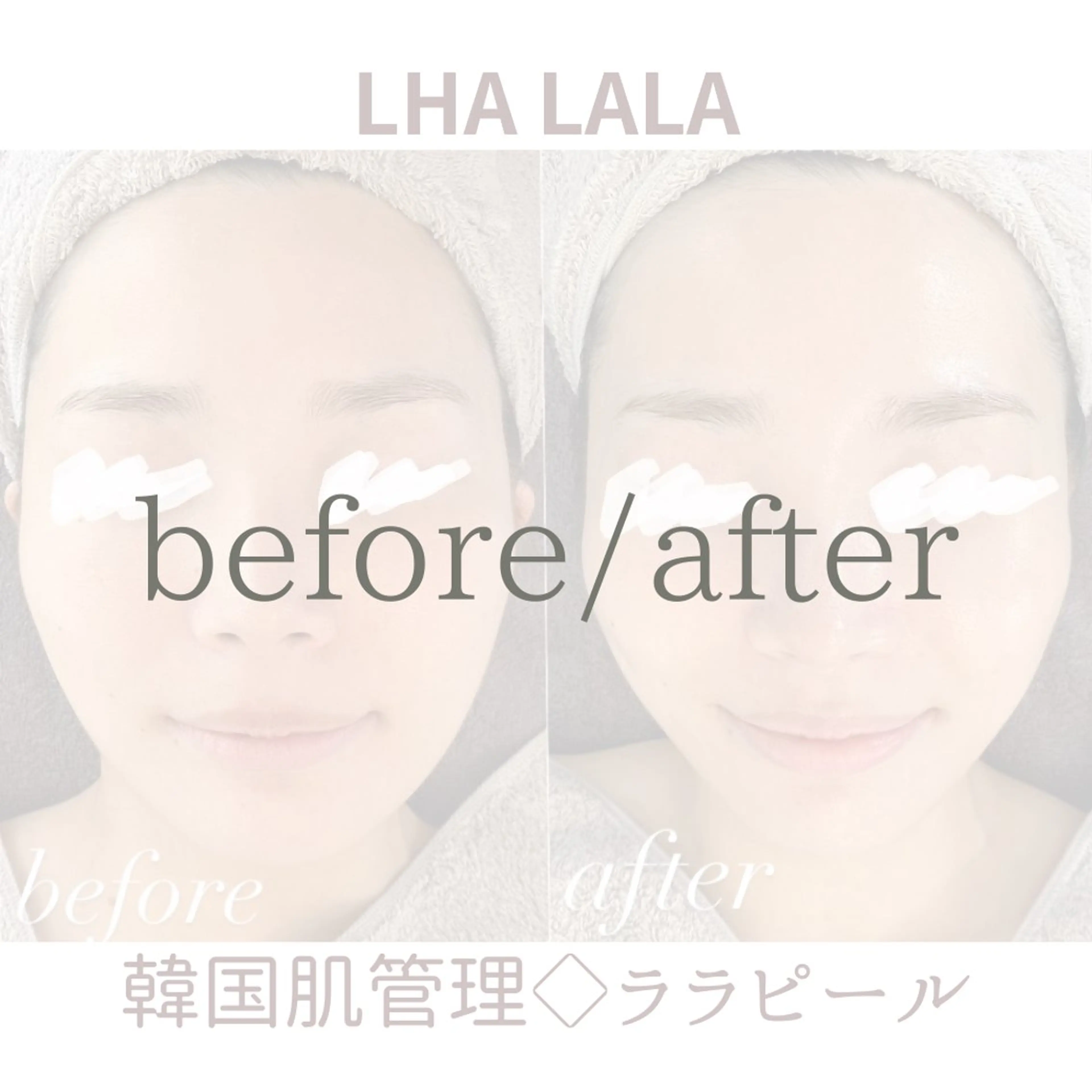 エステ リラク For...天王寺店 リンパ|ヘッドよもぎのエステ・リラクイメージ