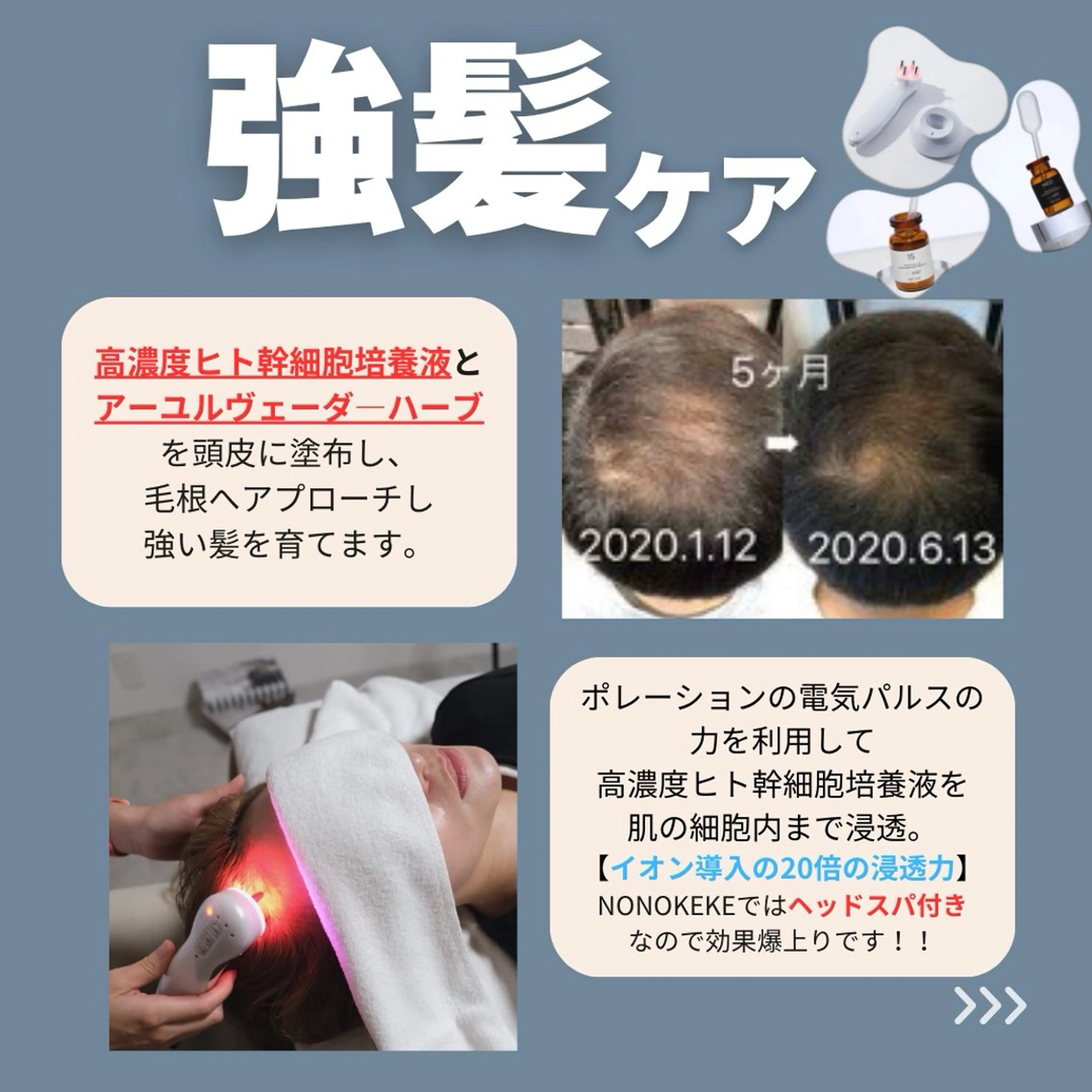 NONOKEKE ノノケケのエステ・リラクイメージ