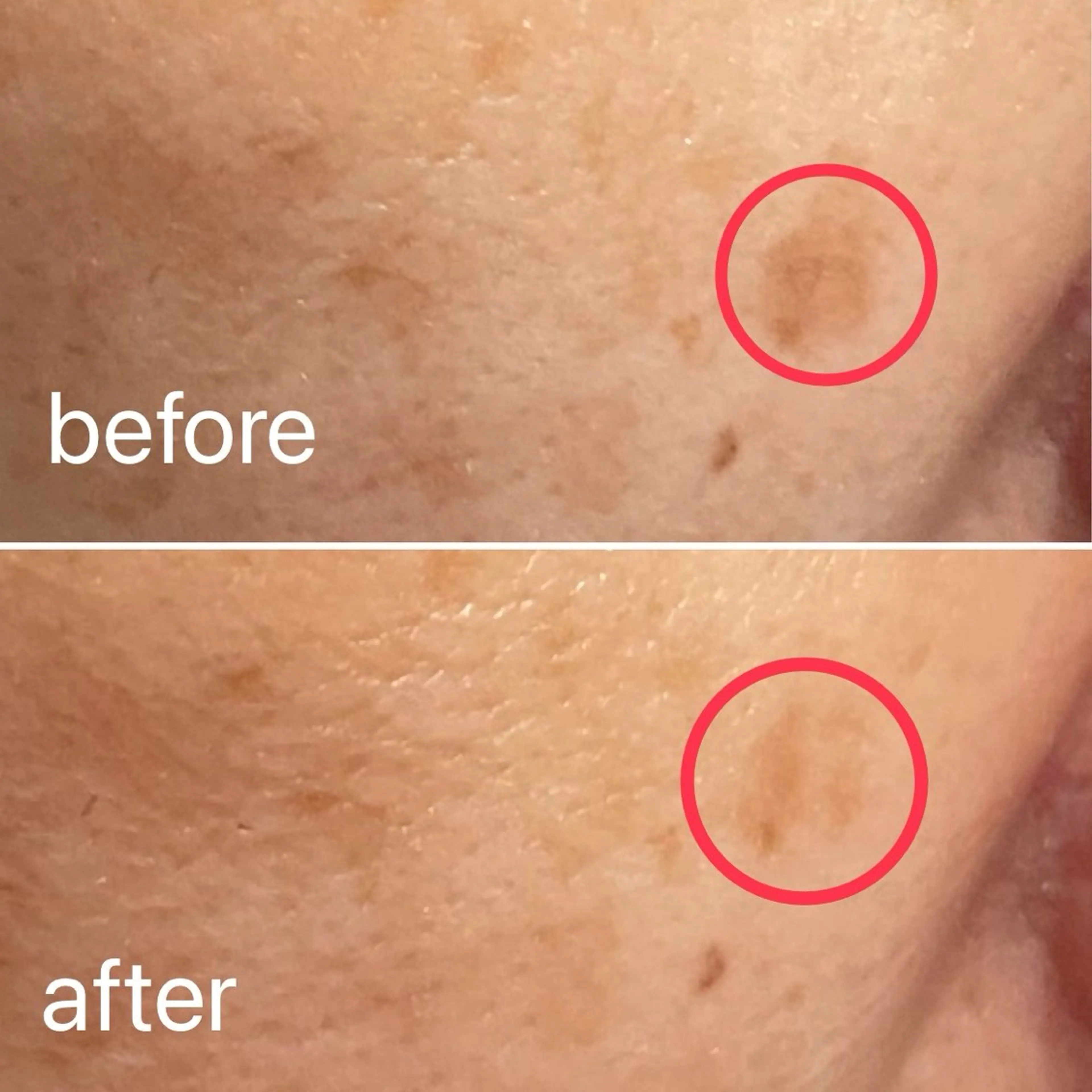 痛くないシミ取り 【荻窪】石橋のヘアスタイル