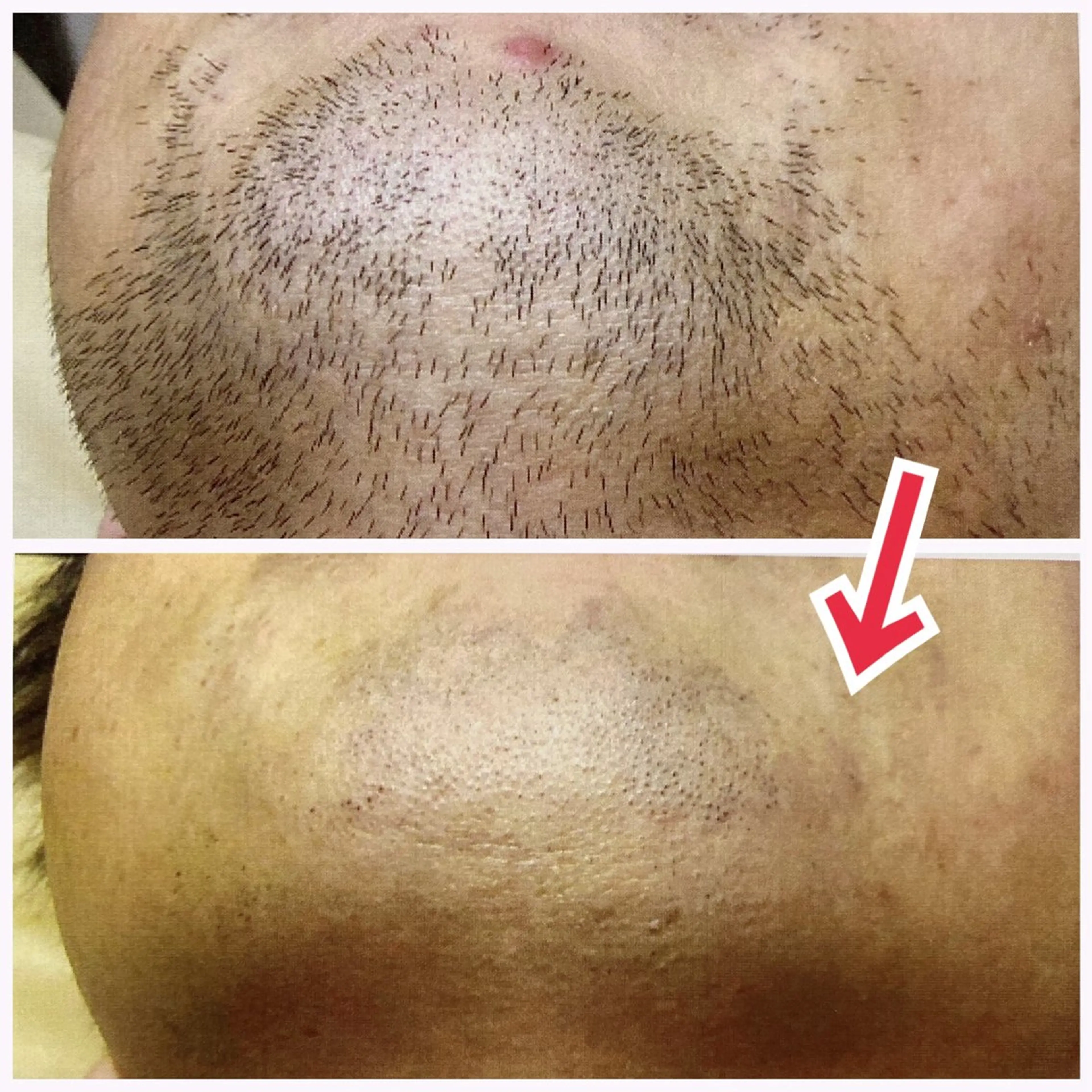 メンズ エステ リラク 通うほど変わる本格 エステ心斎橋REVIのエステ・リラクイメージ