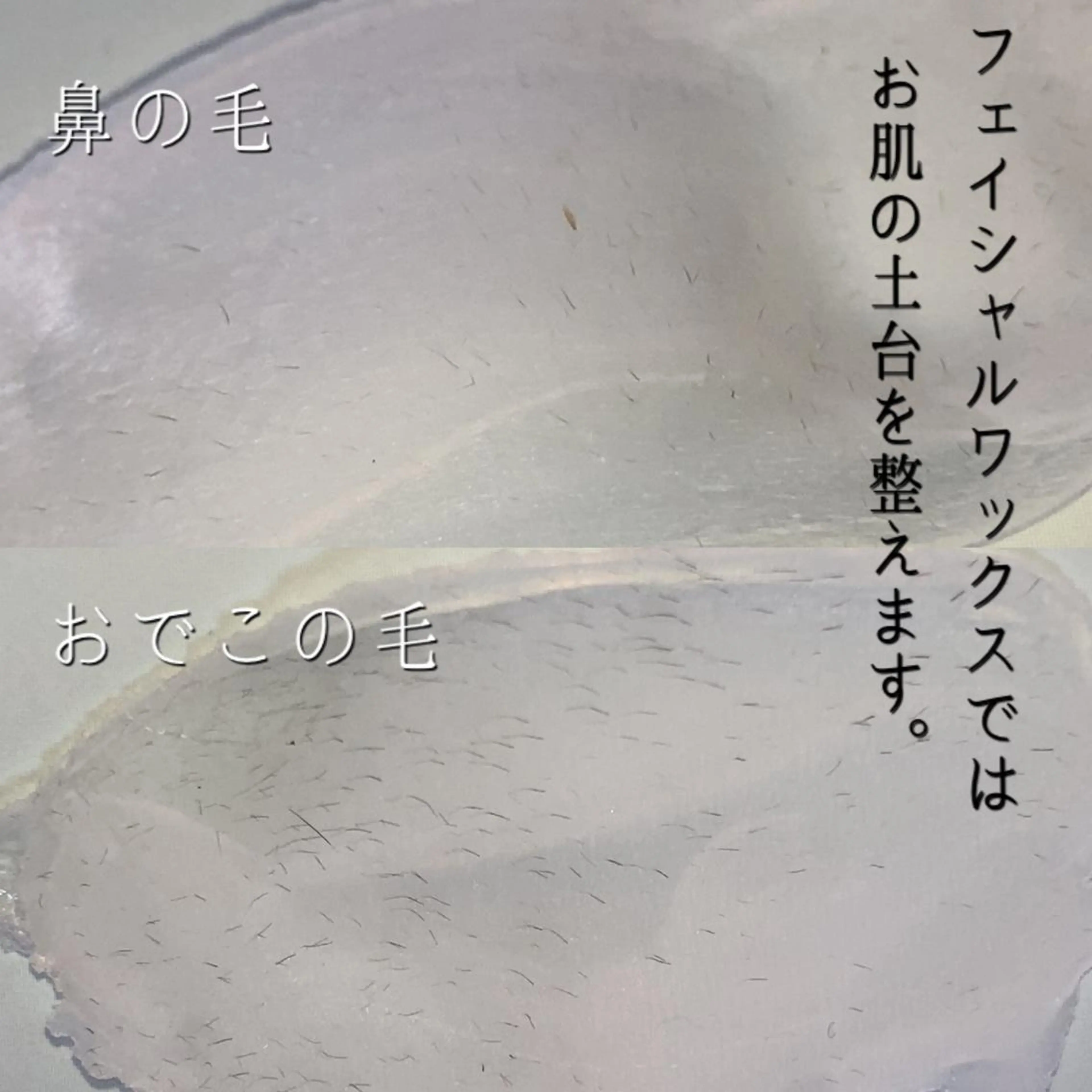 脱毛サロン KiWiのエステ・リラクイメージ