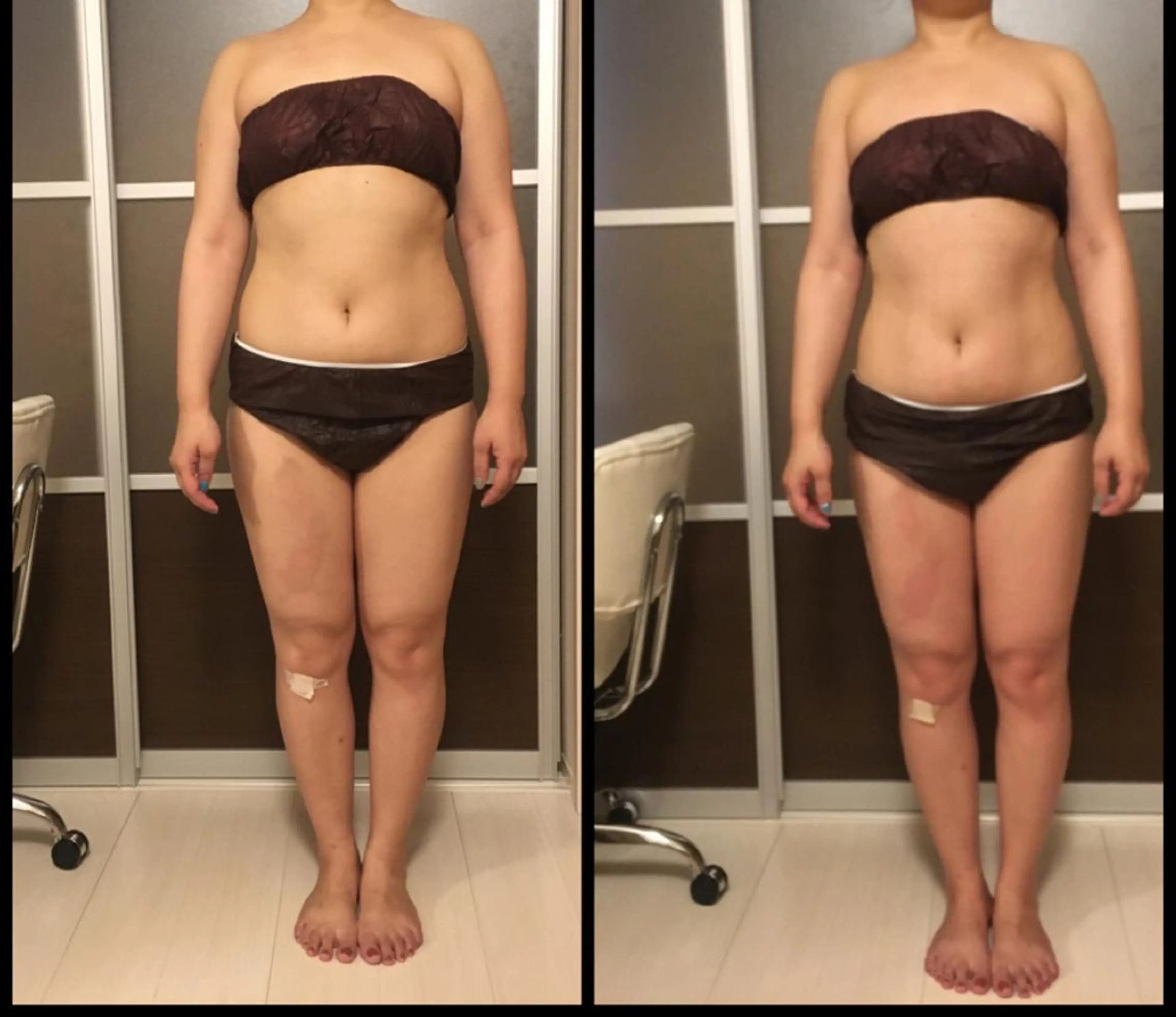 ミディアム カラー パーマ ヘアアレンジ キッズ ネイル マツエク・マツパ アニメ,Vオタク× 即効痩せエステサロンのエステ・リラクイメージ