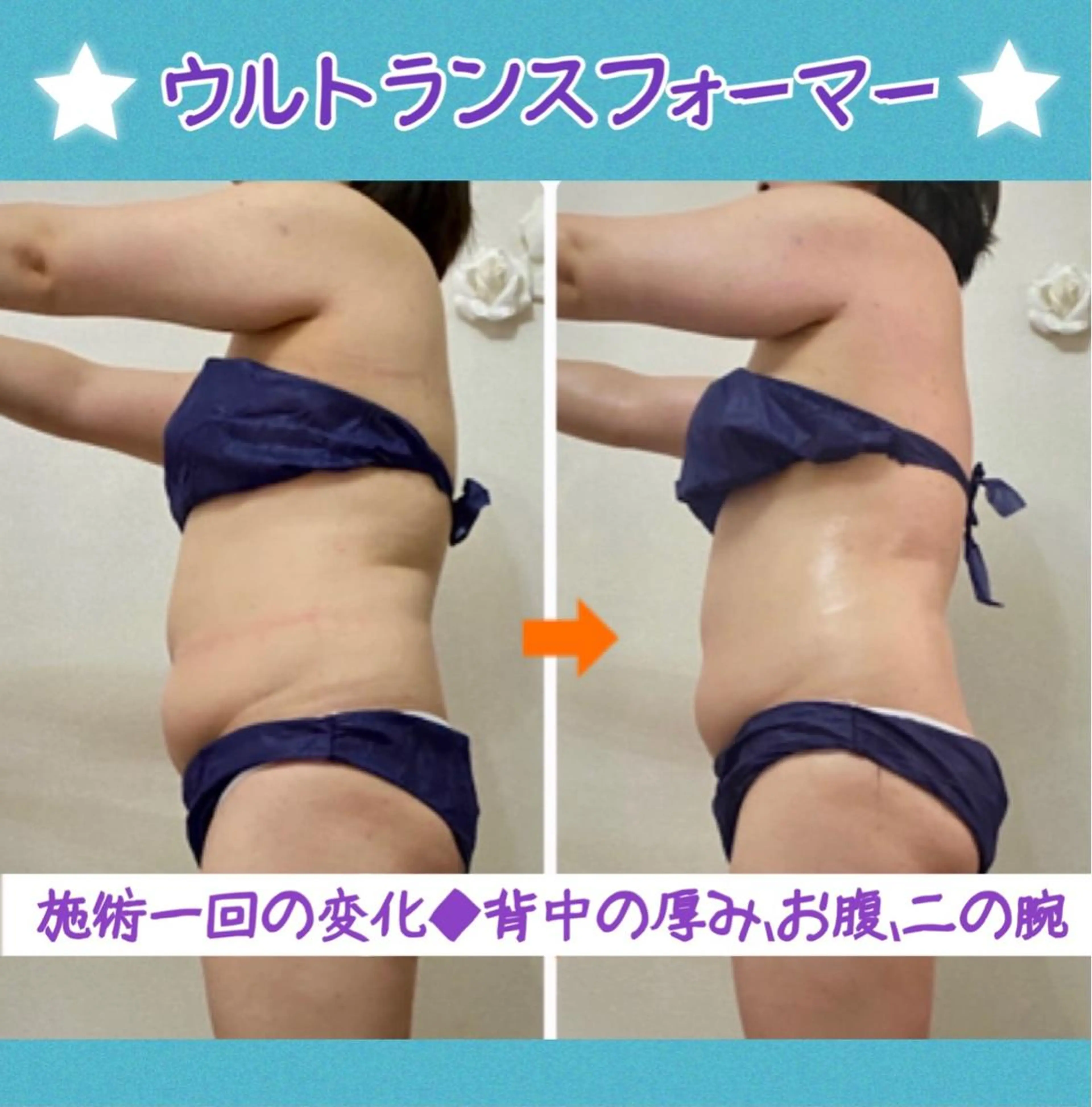 ショート カラー パーマ ヘアアレンジ メンズ キッズ ネイル マツエク・マツパ エステ リラク ‍痩身＆ボディ 結果出し🌟丹野のエステ・リラクイメージ