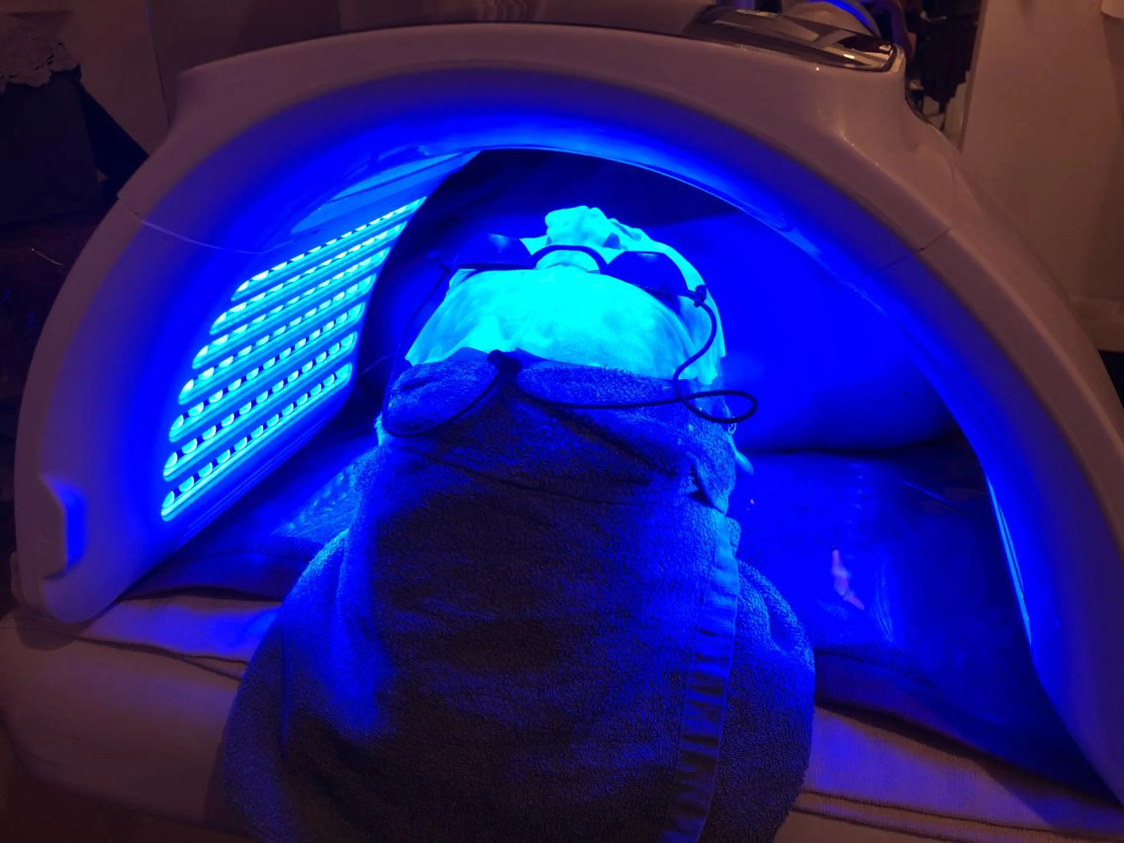 ピーリングコース✨他のピーリングで合わなかった方🌟低刺激にターンオーバーを整える乳酸ピーリング🫧の写真