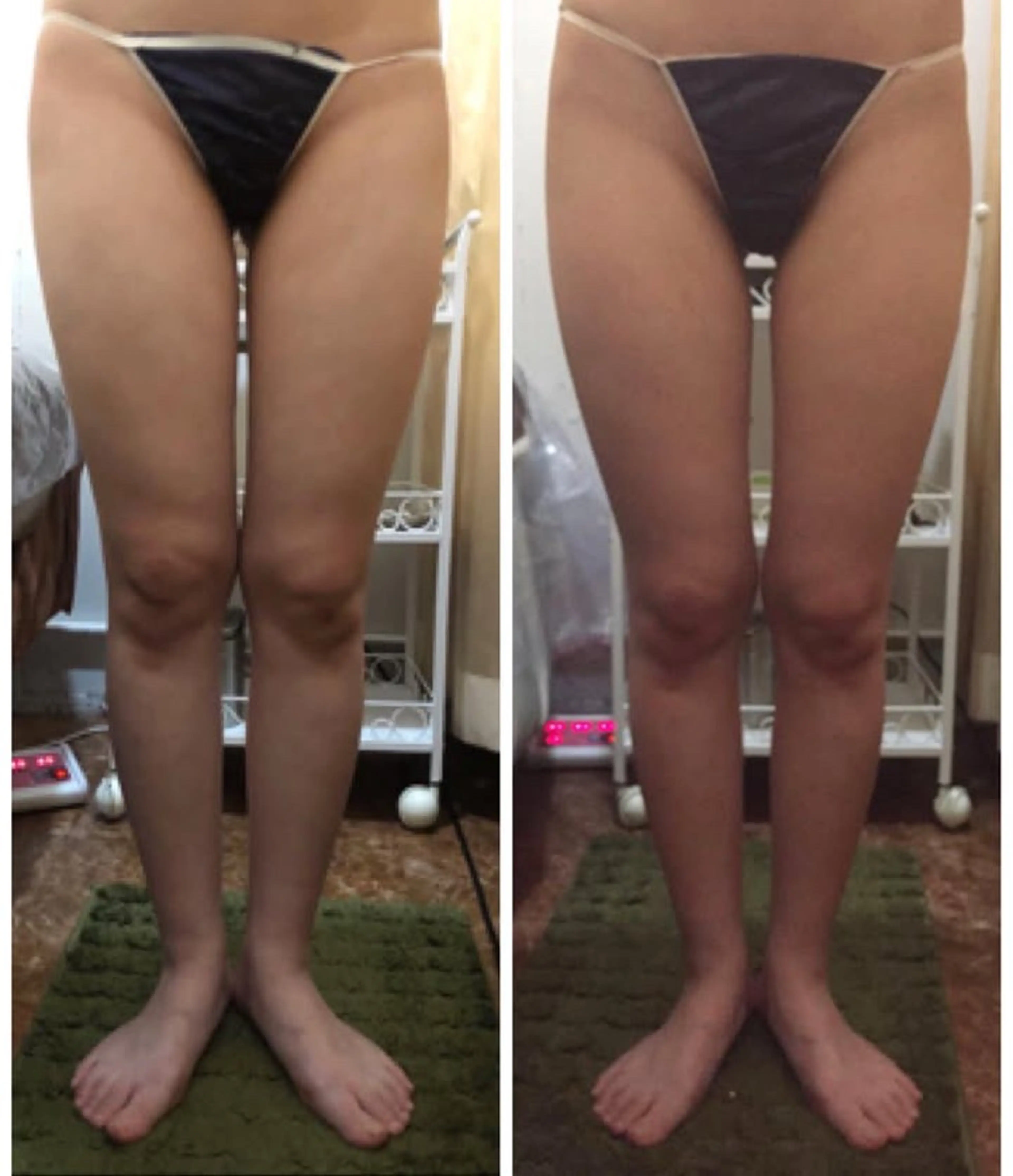 痩せにくい方🔥疲労が取れない方オススメ❣半身ボディ✨セルライト/肩こり/腰痛/むくみ/キレイなラインを作りたい方！の写真