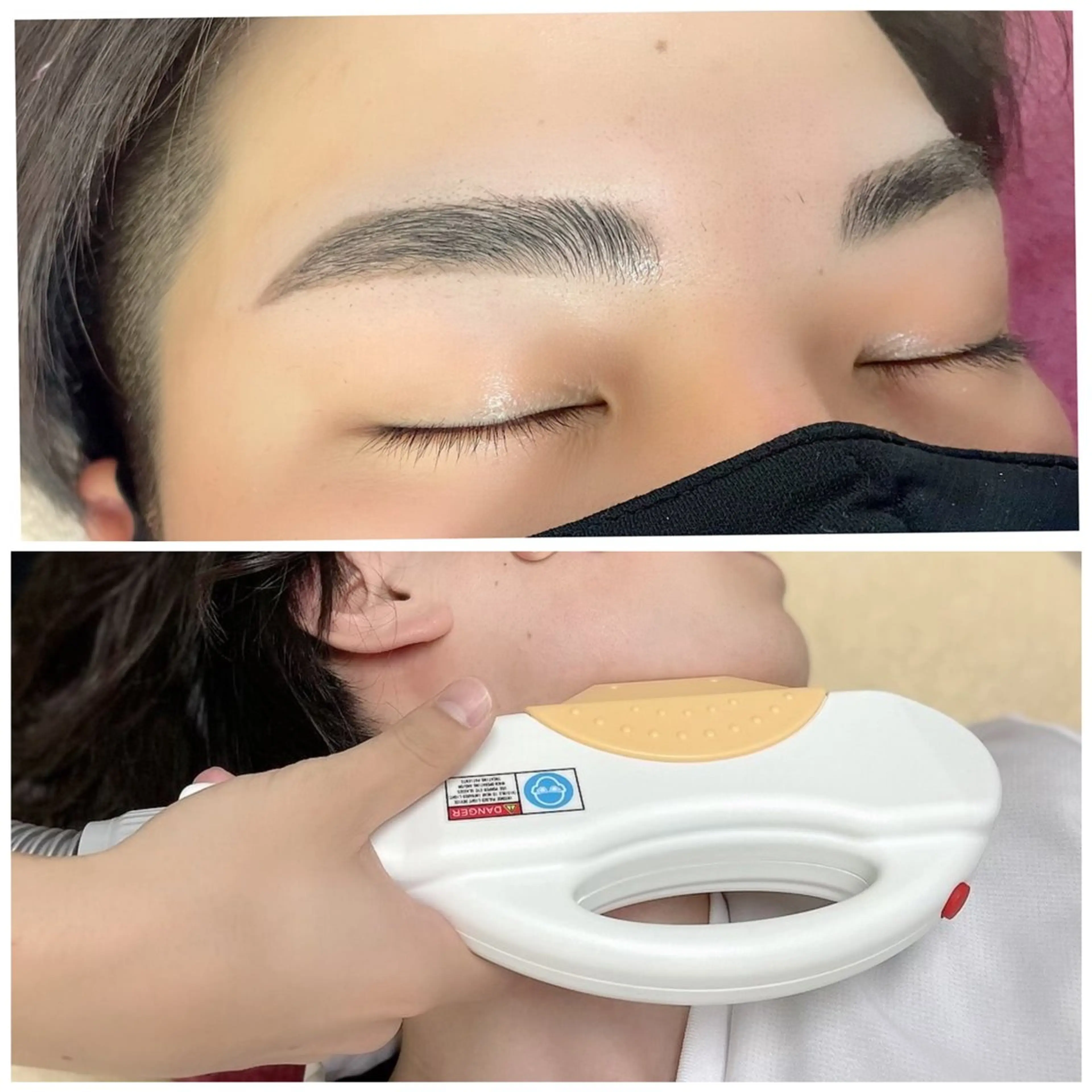 【メンズ】眉ワックス➕肌質改善 光フェイシャルの写真