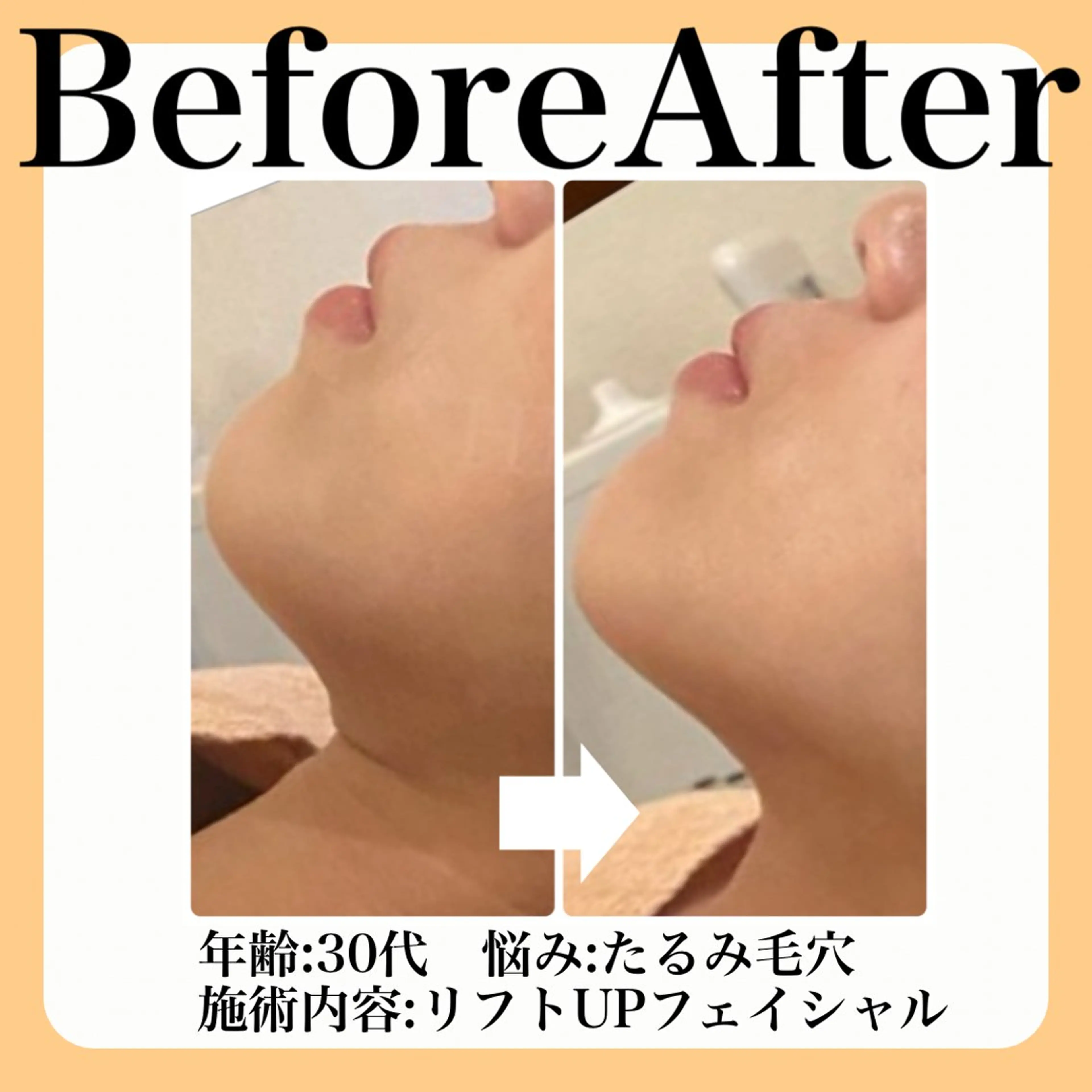 エステ 毛穴・たるみ･ニキビケア専門サロンsui所属・sui【スイ】 ARISAのエステ・リラクイメージ